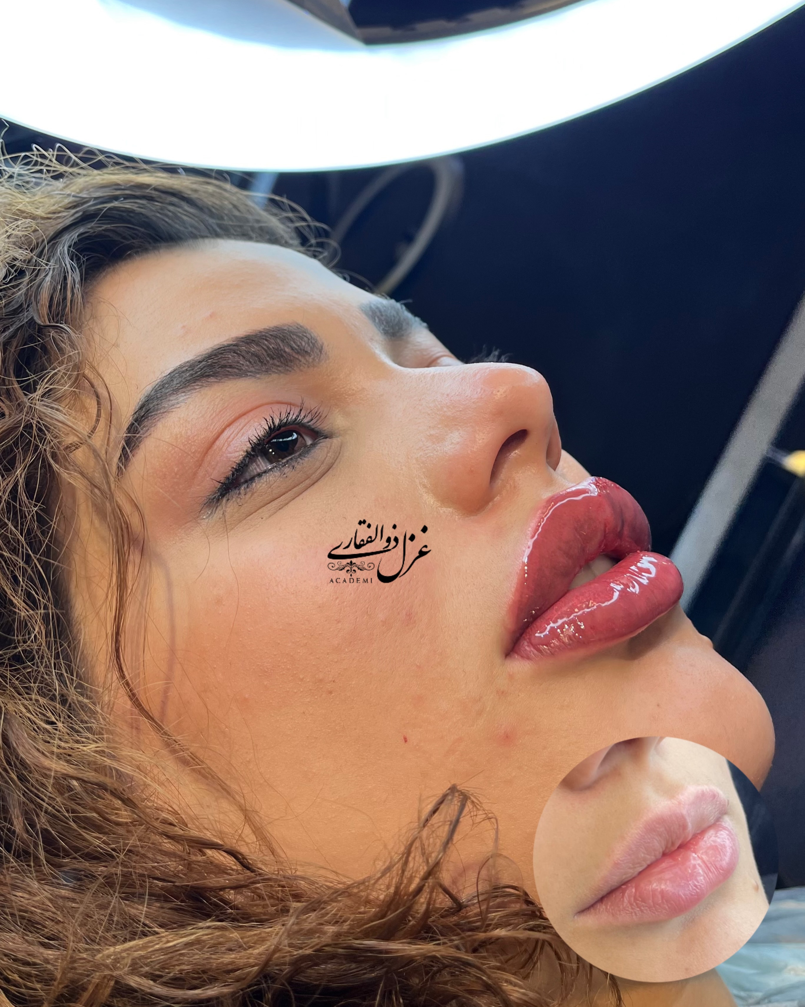 نمونه کار غزل ذوالفقاری — لیفت و لمینت مژه