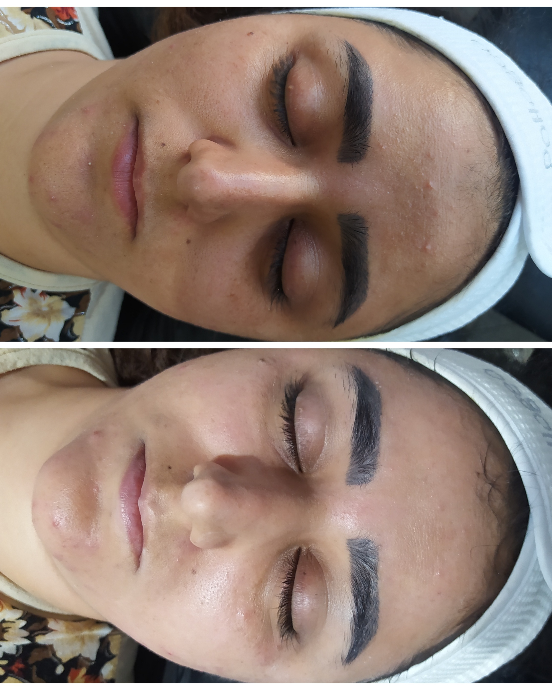 نمونه کار نیاز صنعتی — لیفت و لمینت مژه