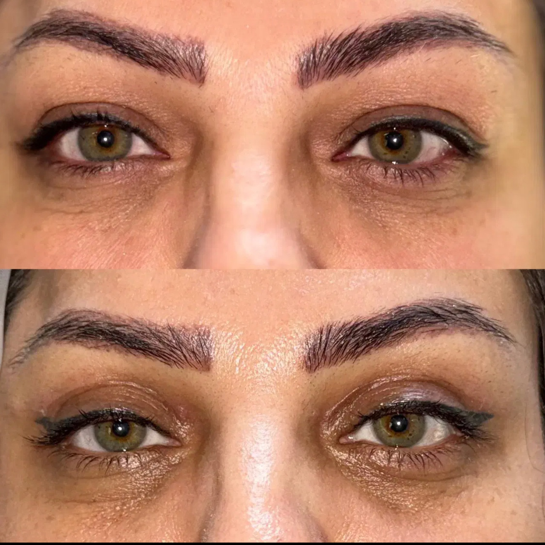 نمونه کار دکتر مسعود افتابی — لیفت و لمینت مژه