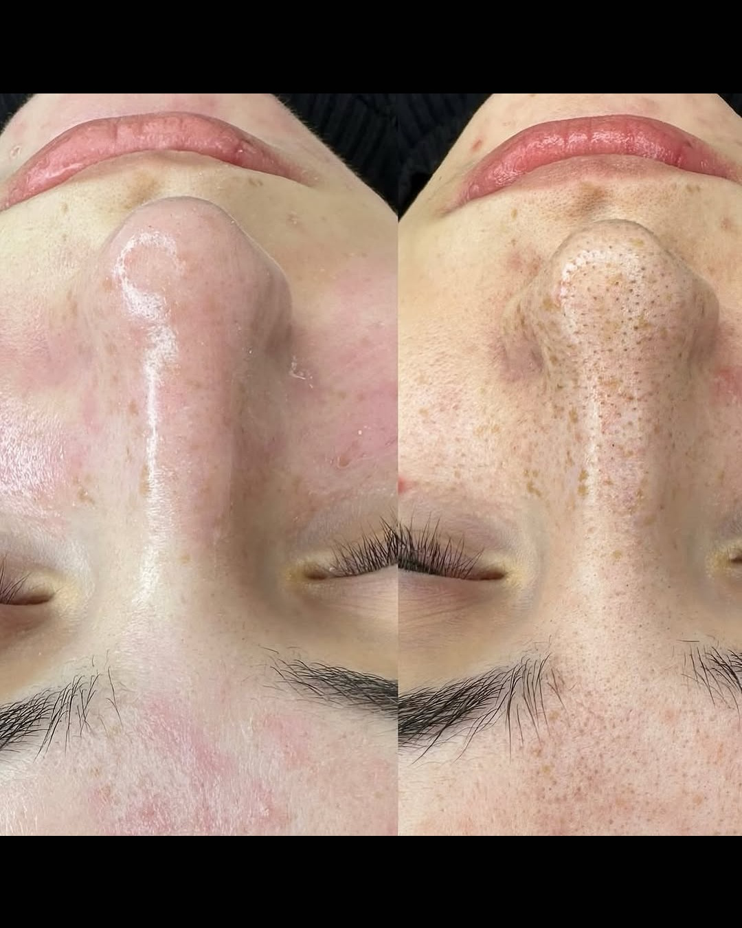 نمونه کار سیمین صنعتی — لیفت و لمینت مژه