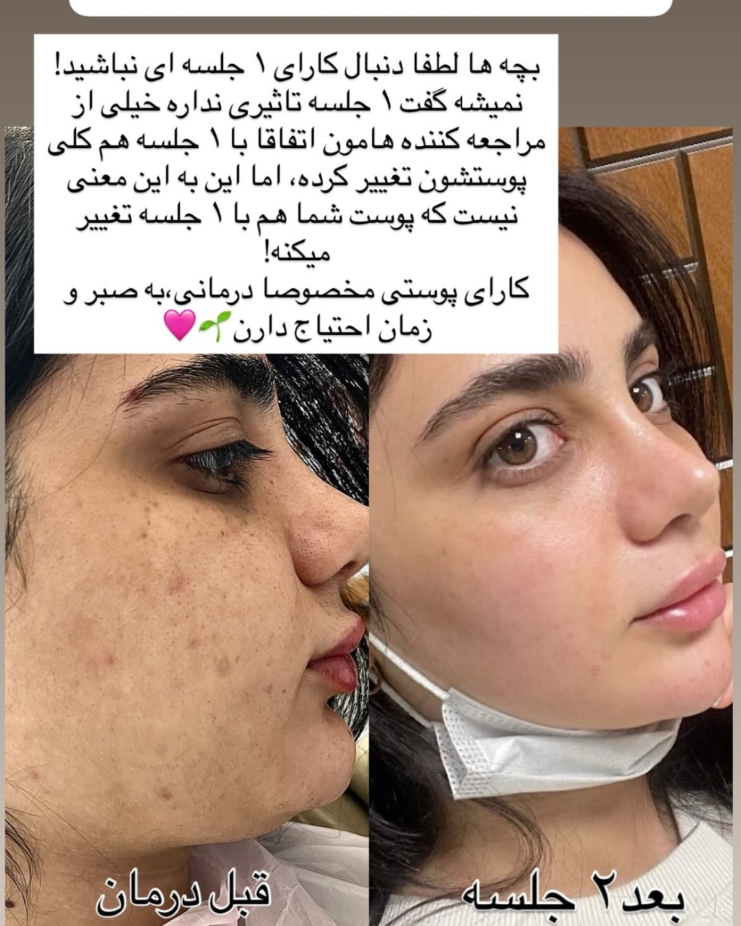 نمونه کار نیاز صنعتی — لیفت و لمینت مژه