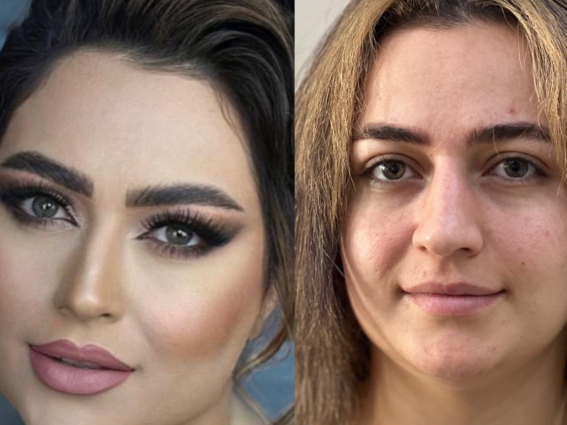 نمونه کار ندا دره شیری — لیفت و لمینت مژه