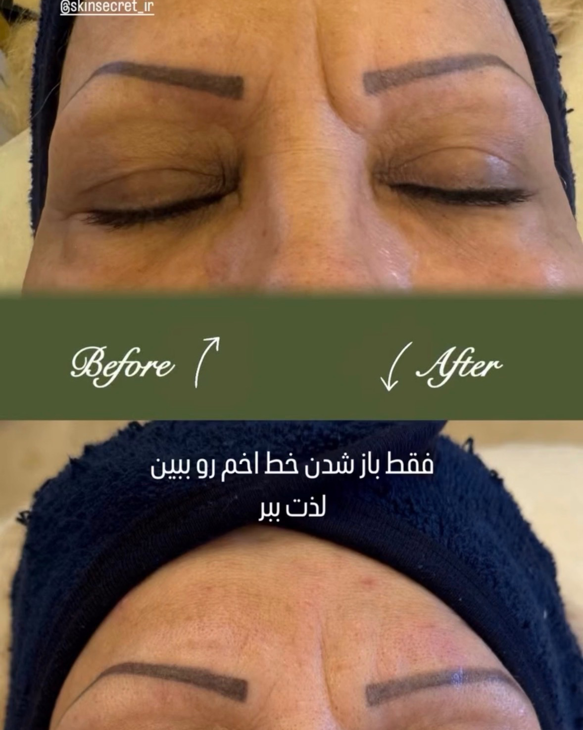 نمونه کار سارا مخبری — لیفت و لمینت مژه