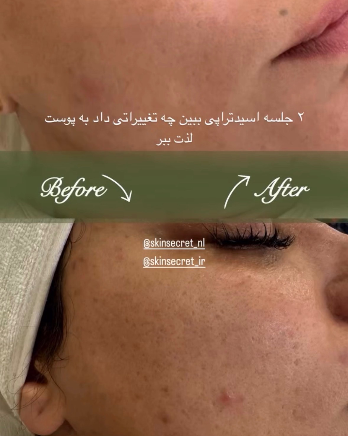 نمونه کار سارا مخبری — لیفت و لمینت مژه