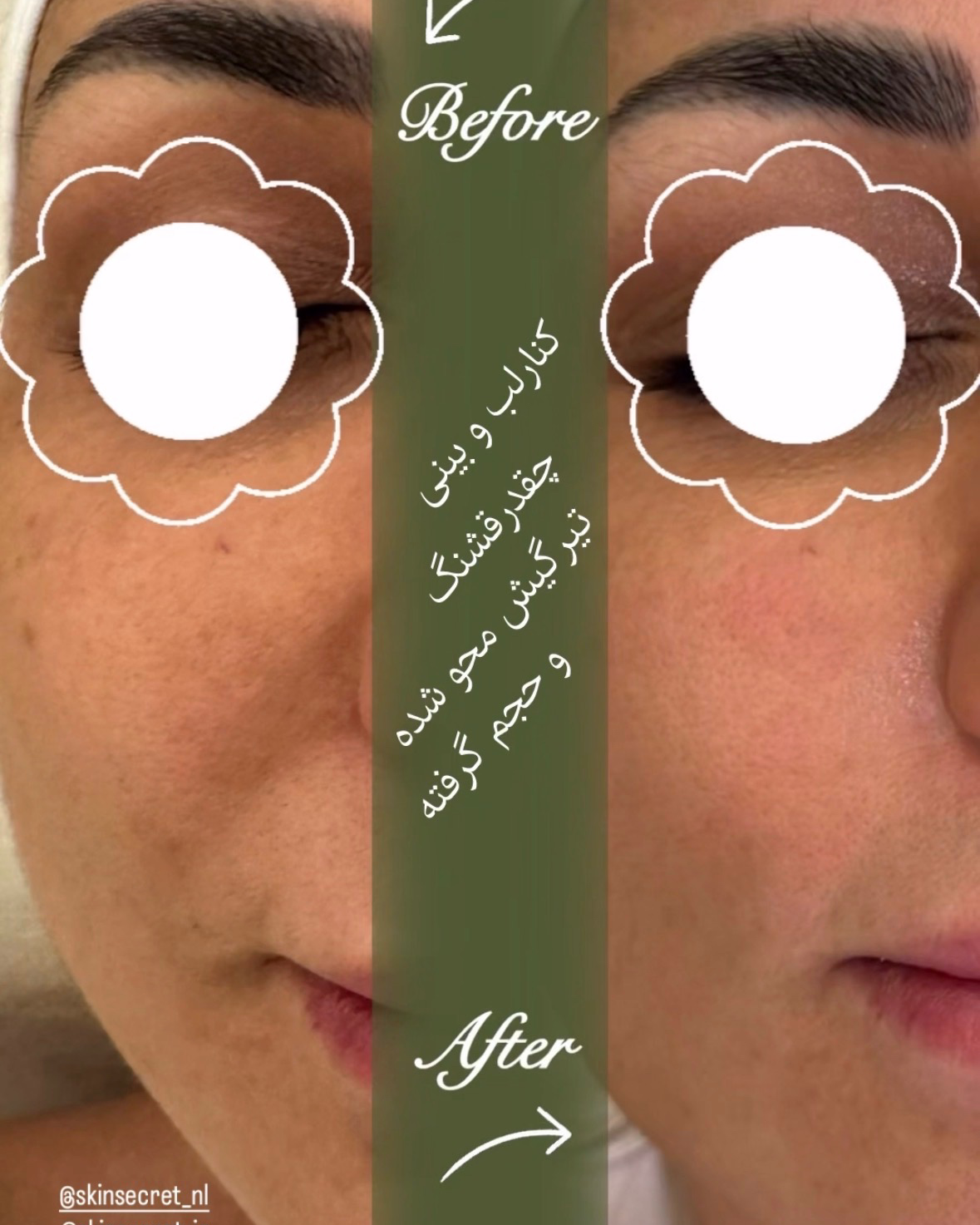 نمونه کار سارا مخبری — لیفت و لمینت مژه
