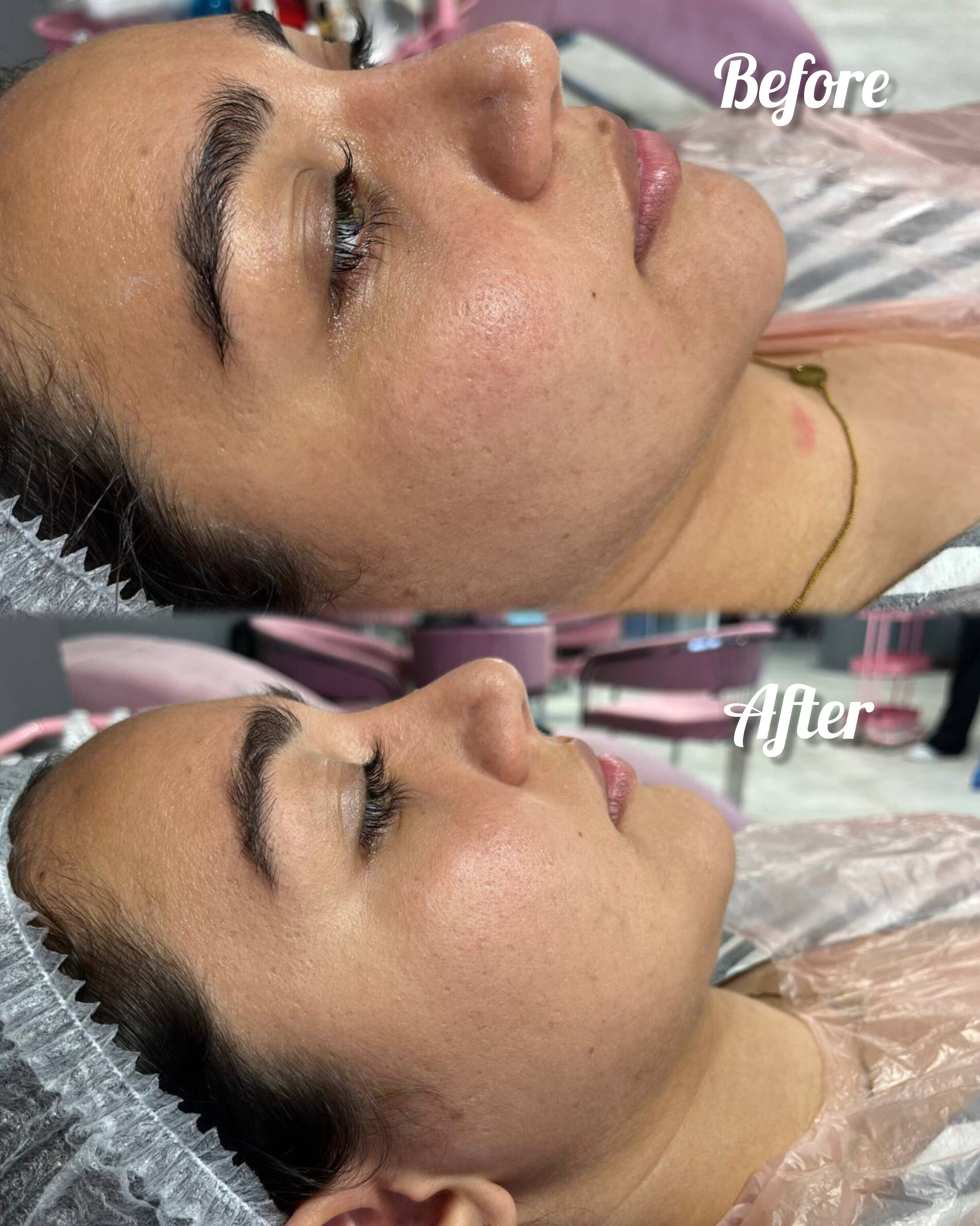 نمونه کار تارا امینی ثابت — لیفت و لمینت مژه