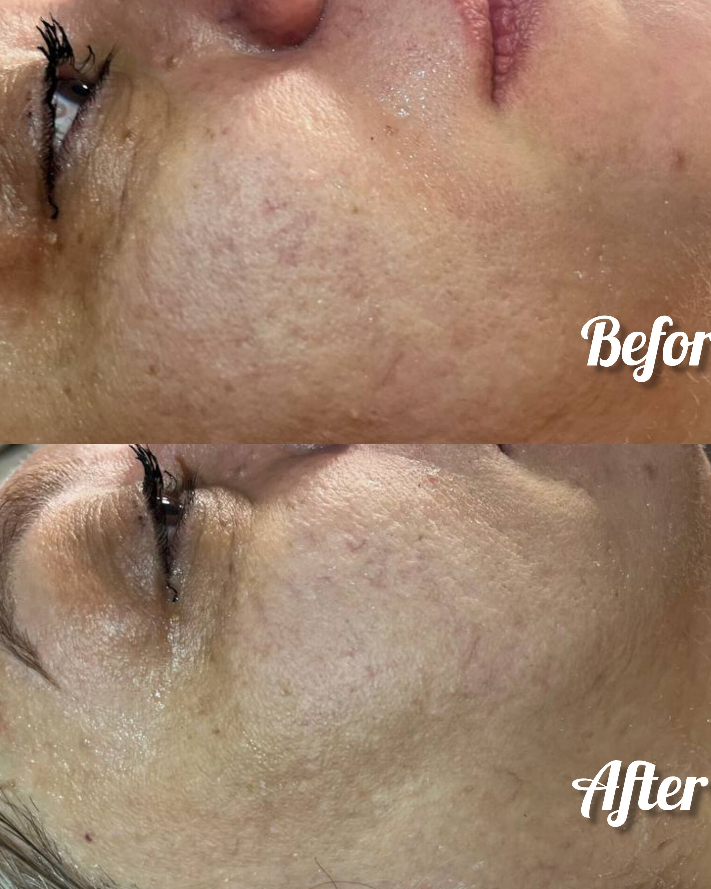 نمونه کار تارا امینی ثابت — لیفت و لمینت مژه