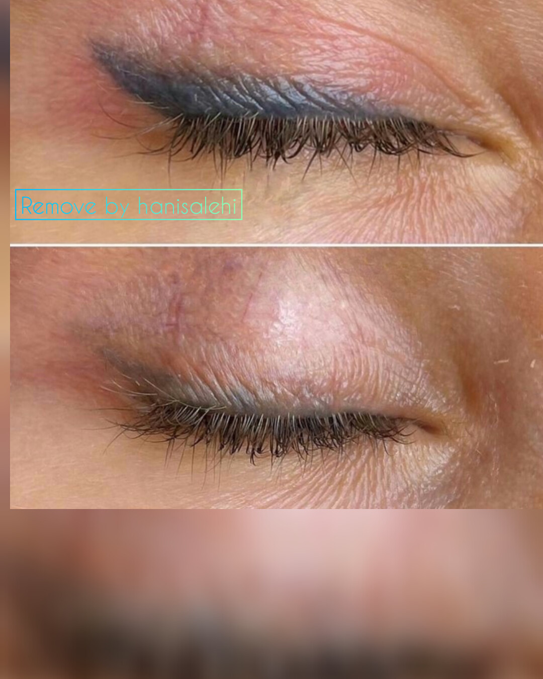 نمونه کار حانیه صالحی — لیفت و لمینت مژه