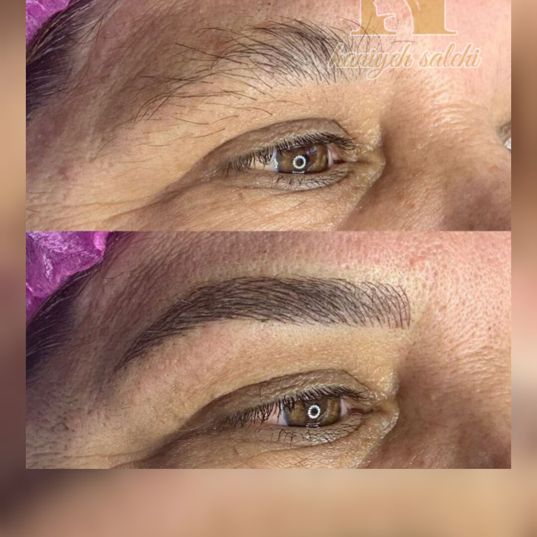 نمونه کار حانیه صالحی — لیفت و لمینت مژه