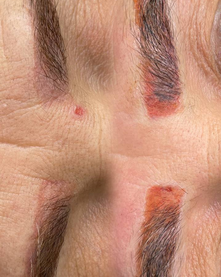 نمونه کار حانیه صالحی — لیفت و لمینت مژه