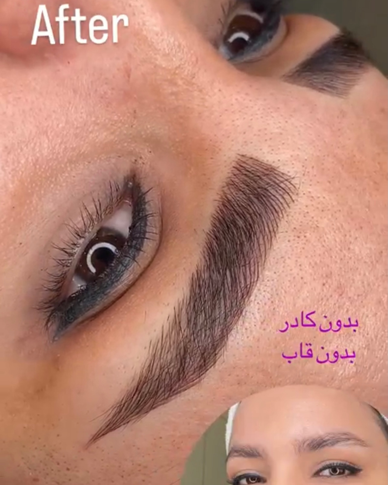 نمونه کار زهره پرهیزکاری — لیفت و لمینت مژه