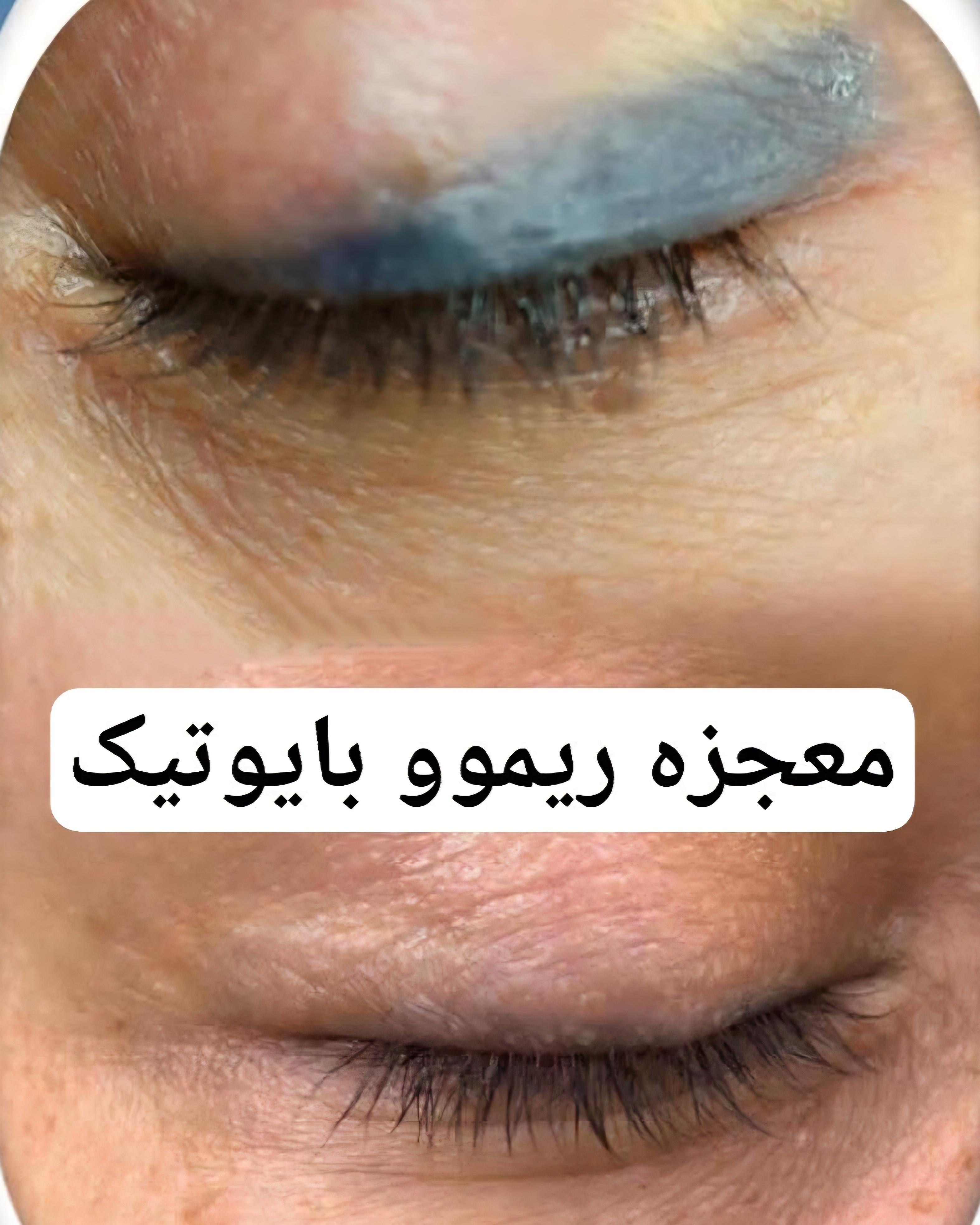 نمونه کار گندم فلاحی — لیفت و لمینت مژه