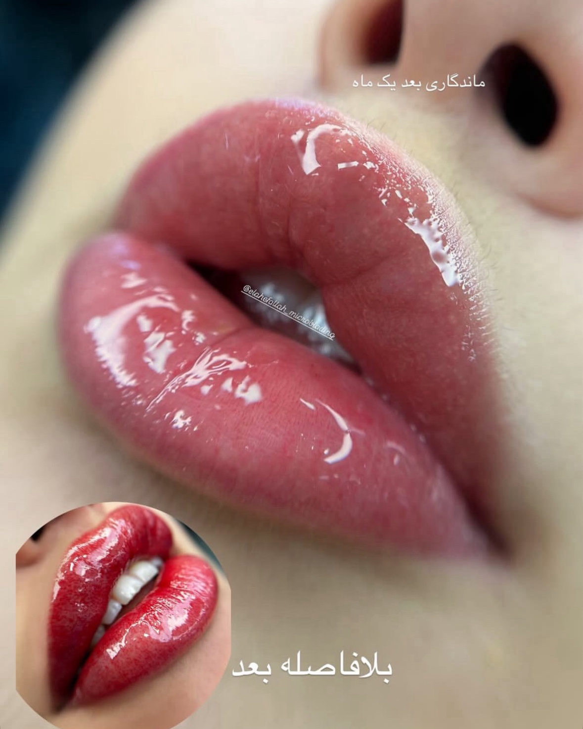 نمونه کار انسیه مرادی تفرشی — لیفت و لمینت مژه