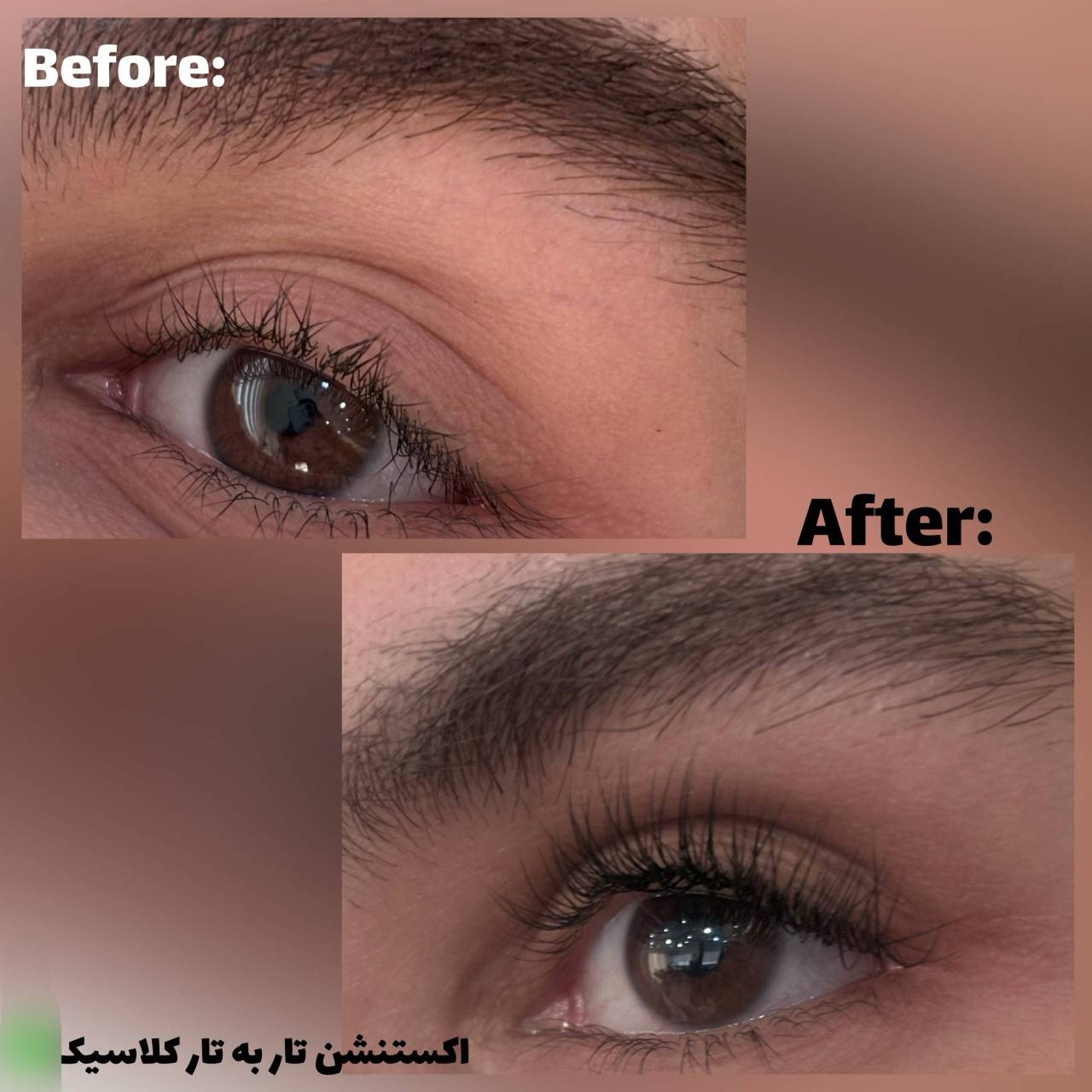 نمونه کار رویا سرحدی — لیفت و لمینت مژه