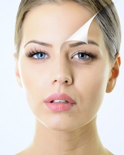 نمونه کار رویا سرحدی — لیفت و لمینت مژه