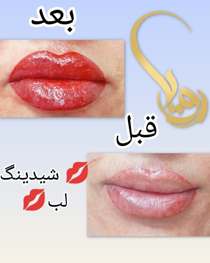 نمونه کار رویا سرحدی — لیفت و لمینت مژه