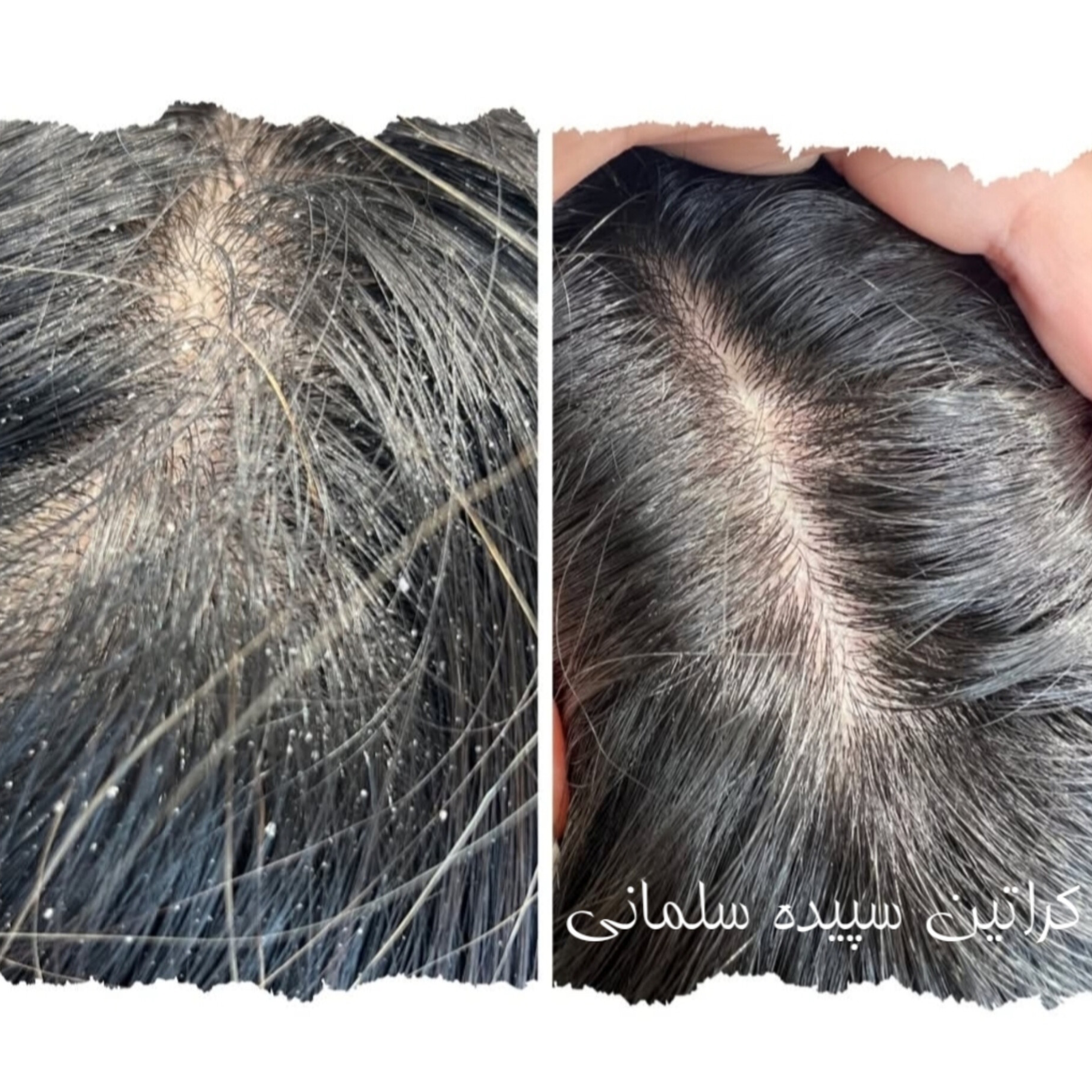 نمونه کار سپیده سلمانی — لیفت و لمینت مژه
