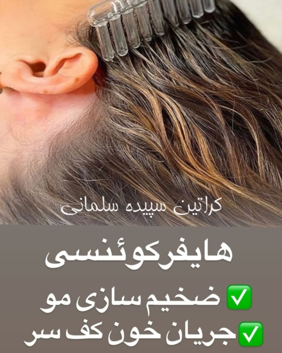 نمونه کار سپیده سلمانی — لیفت و لمینت مژه