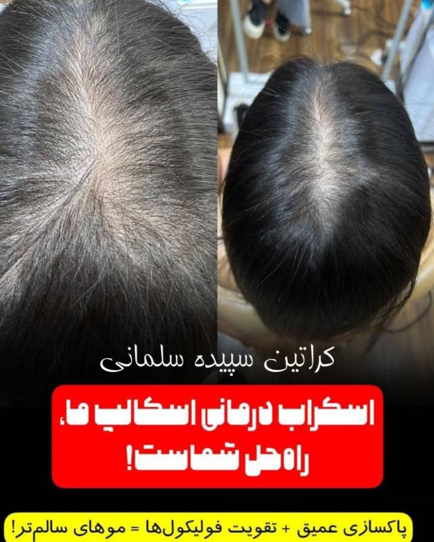 نمونه کار سپیده سلمانی — لیفت و لمینت مژه