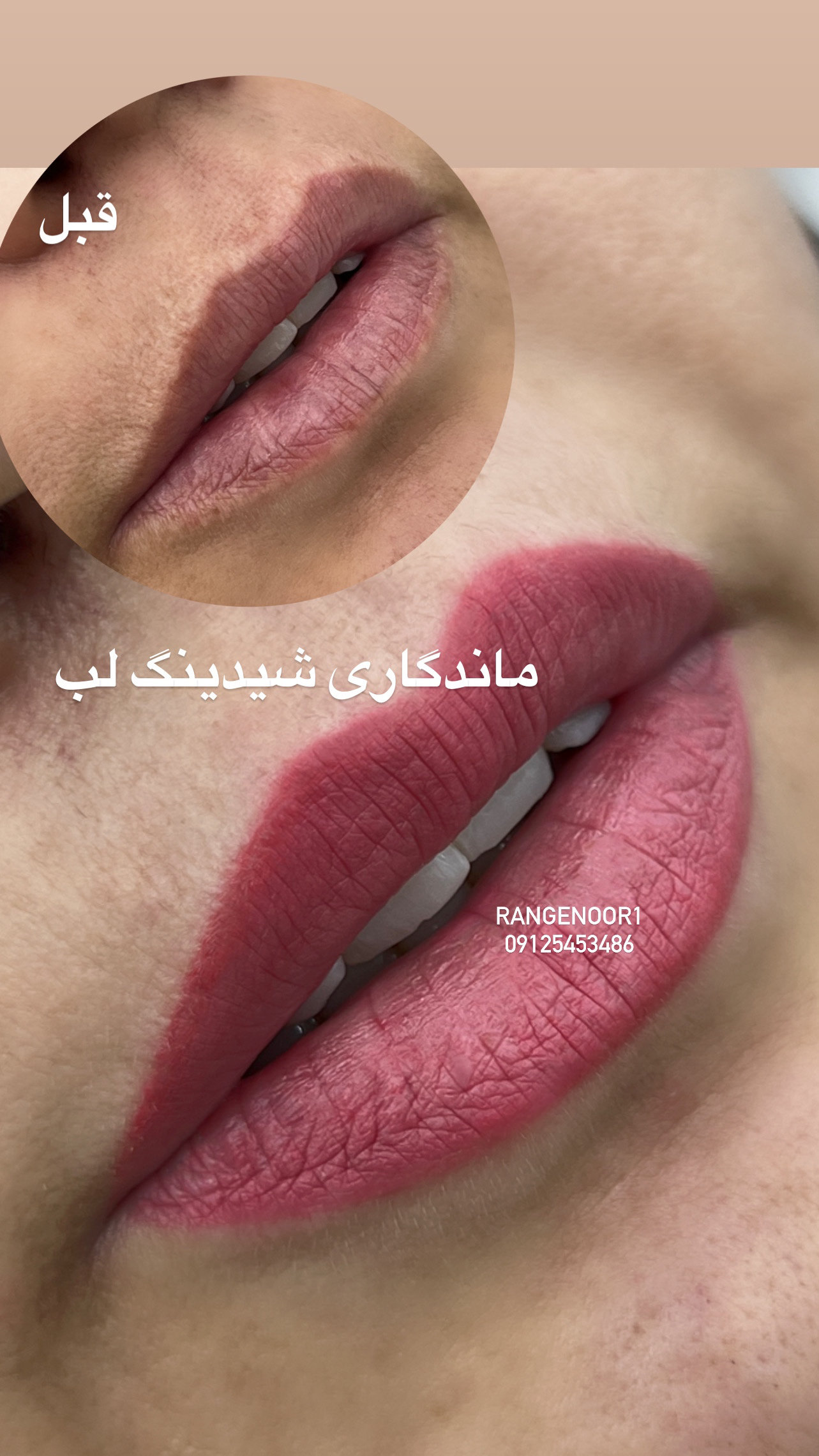 نمونه کار پروانه تقی پور — لیفت و لمینت مژه