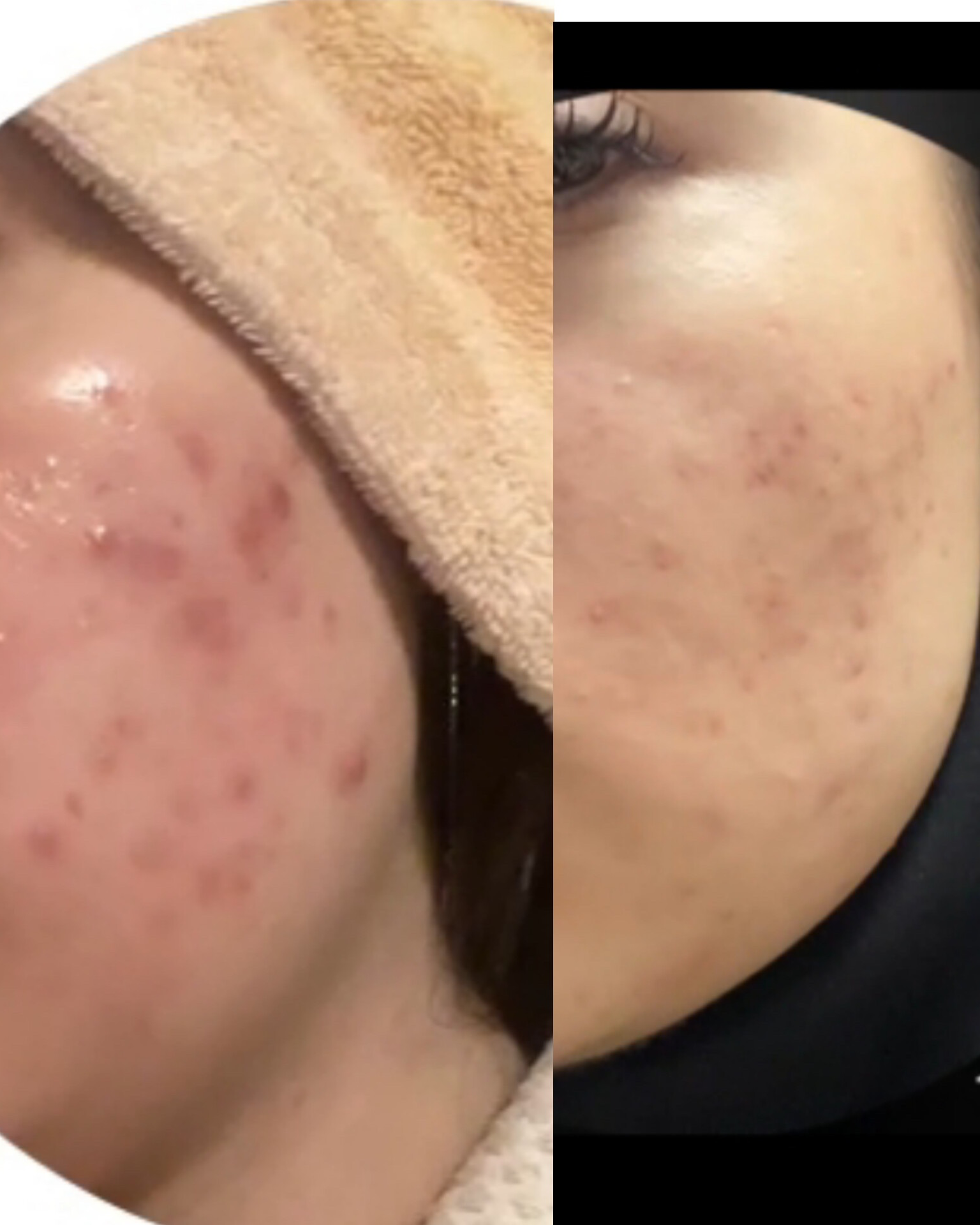 نمونه کار تارا ورجاوند — لیفت و لمینت مژه