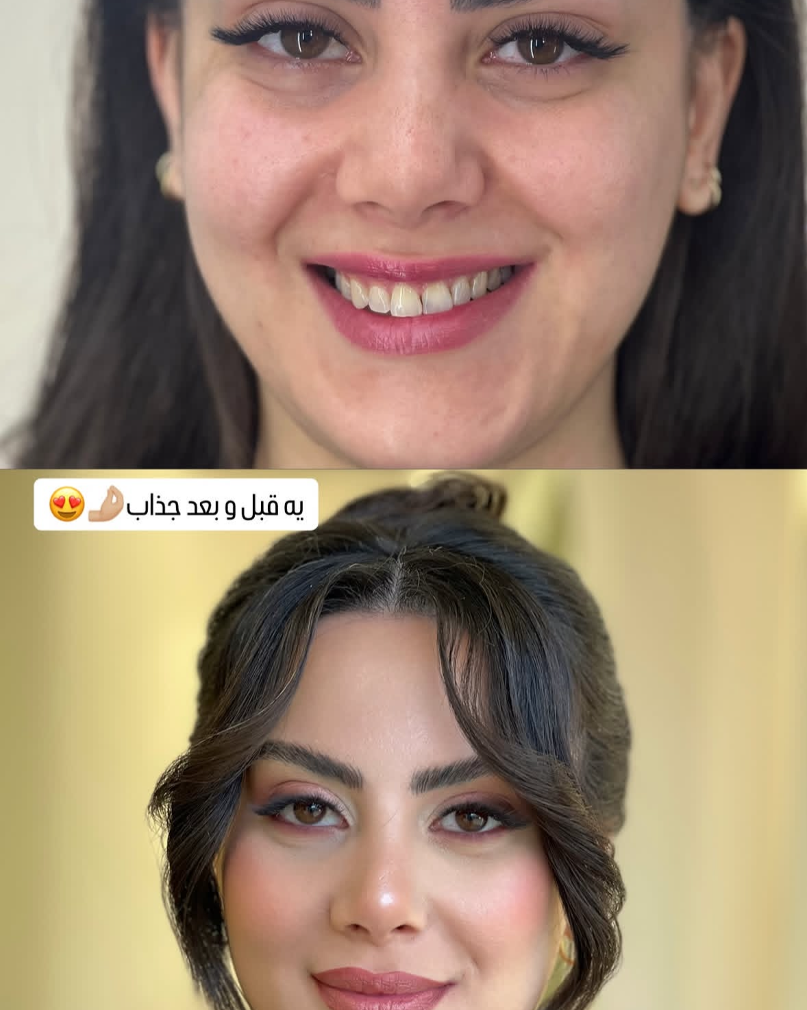 نمونه کار شیوا نصیری — لیفت و لمینت مژه