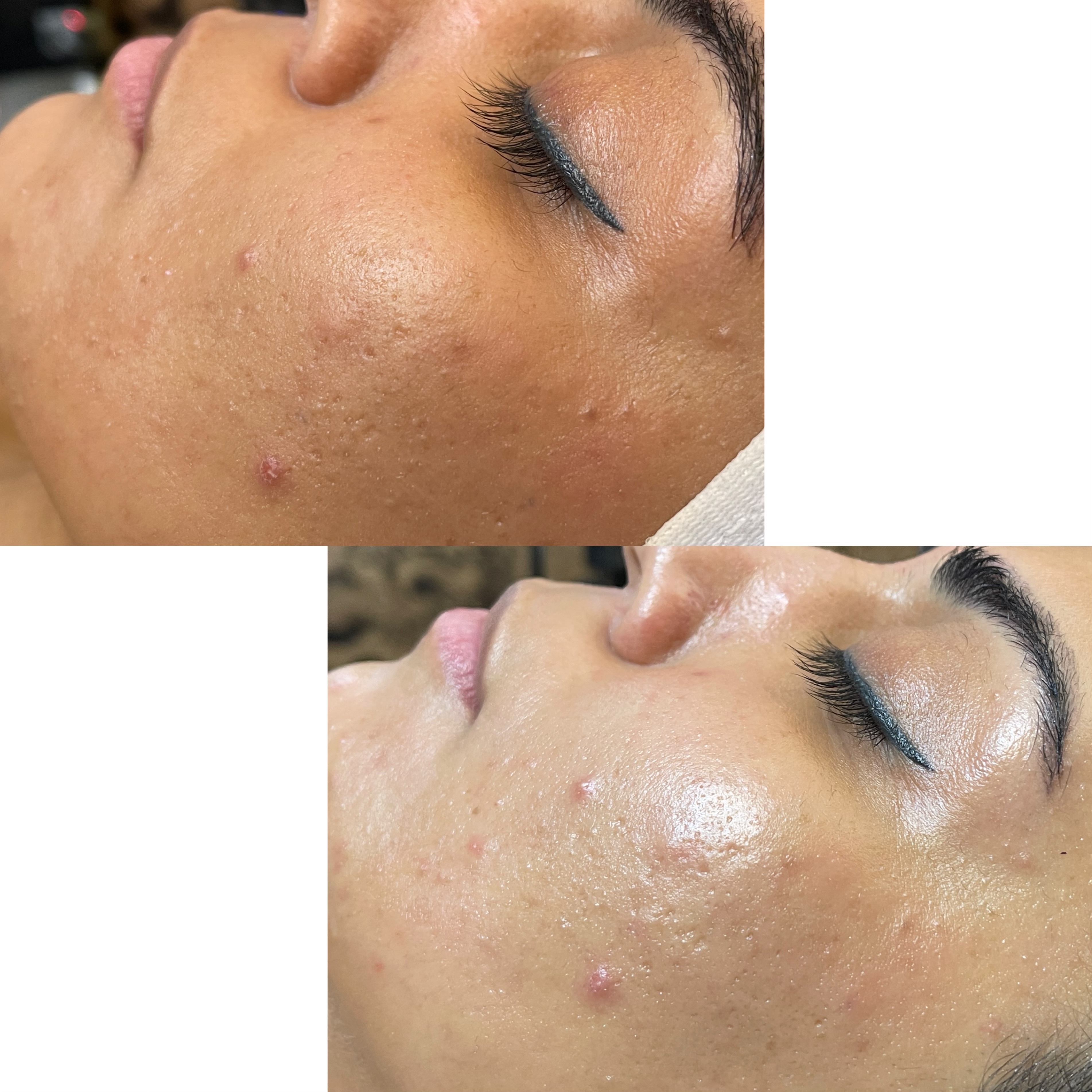 نمونه کار سیما راد — لیفت و لمینت مژه