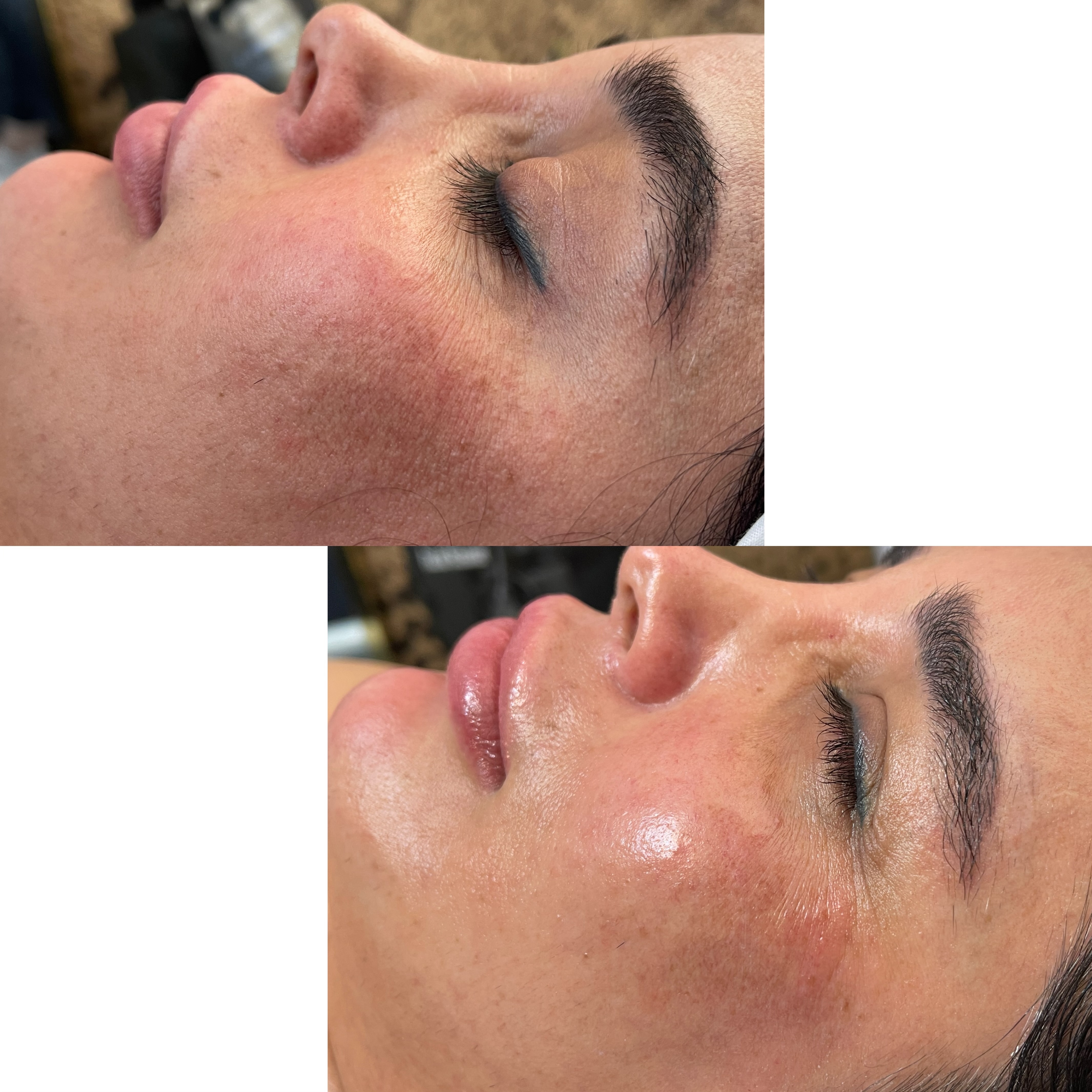 نمونه کار سیما راد — لیفت و لمینت مژه