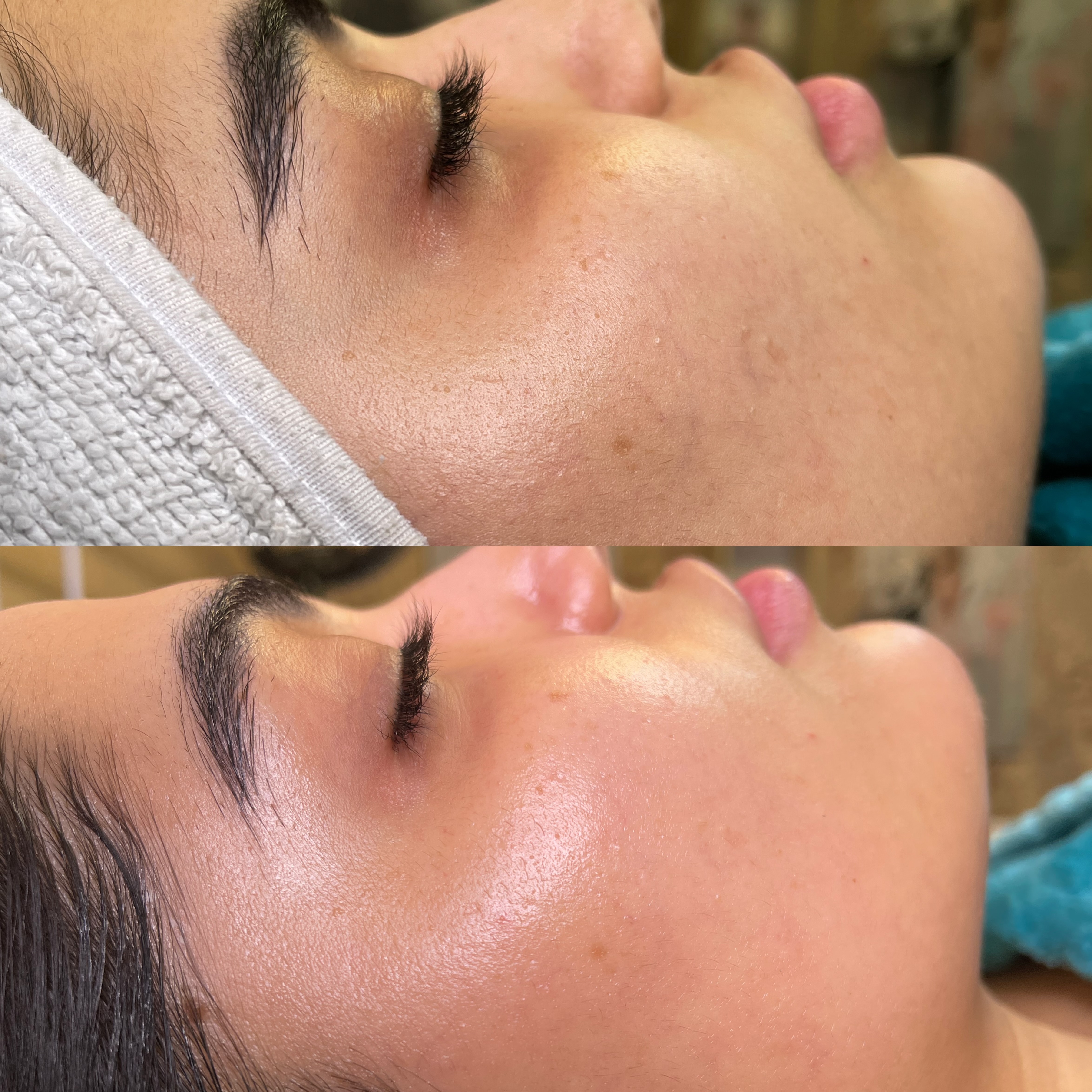 نمونه کار سیما راد — لیفت و لمینت مژه