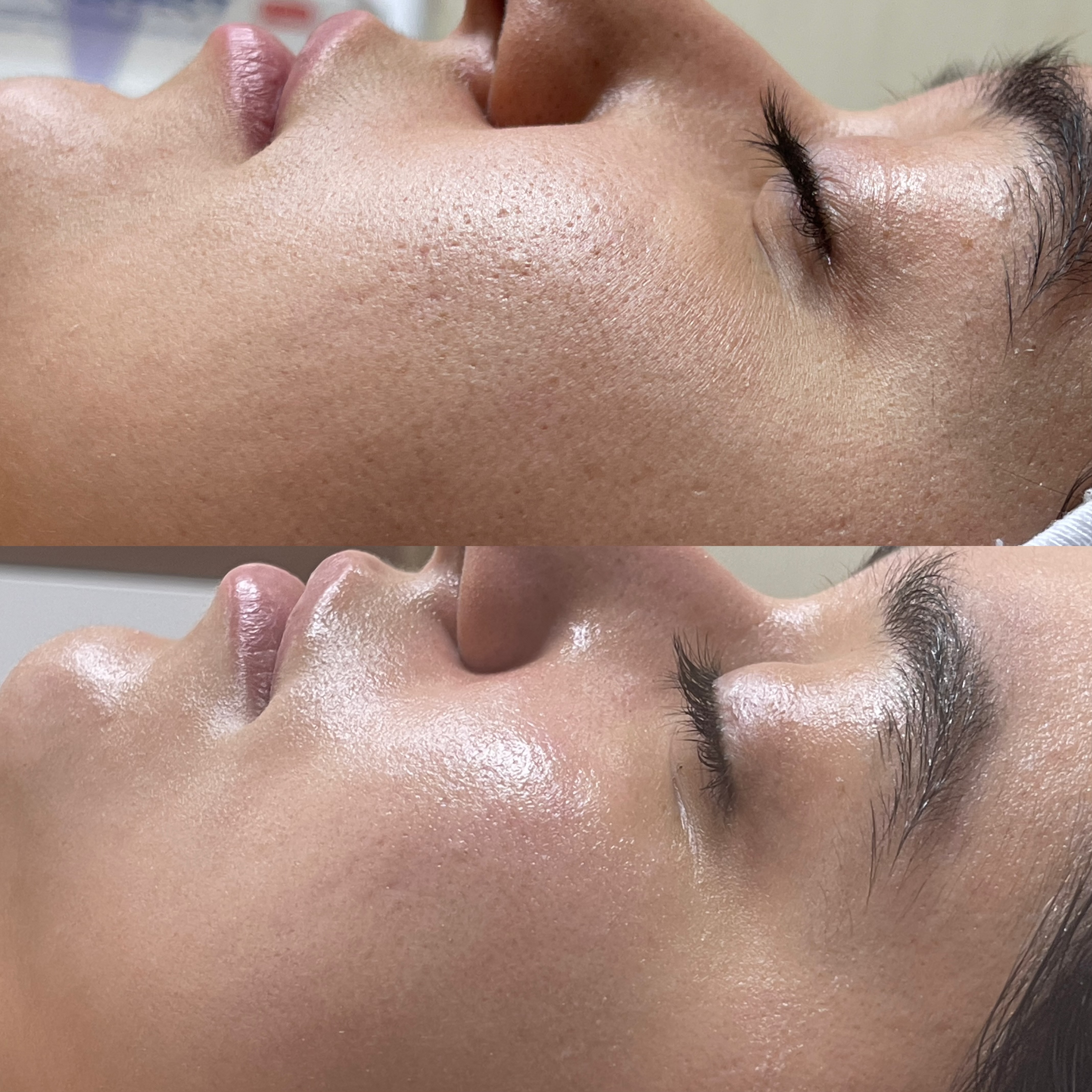 نمونه کار سیما راد — لیفت و لمینت مژه