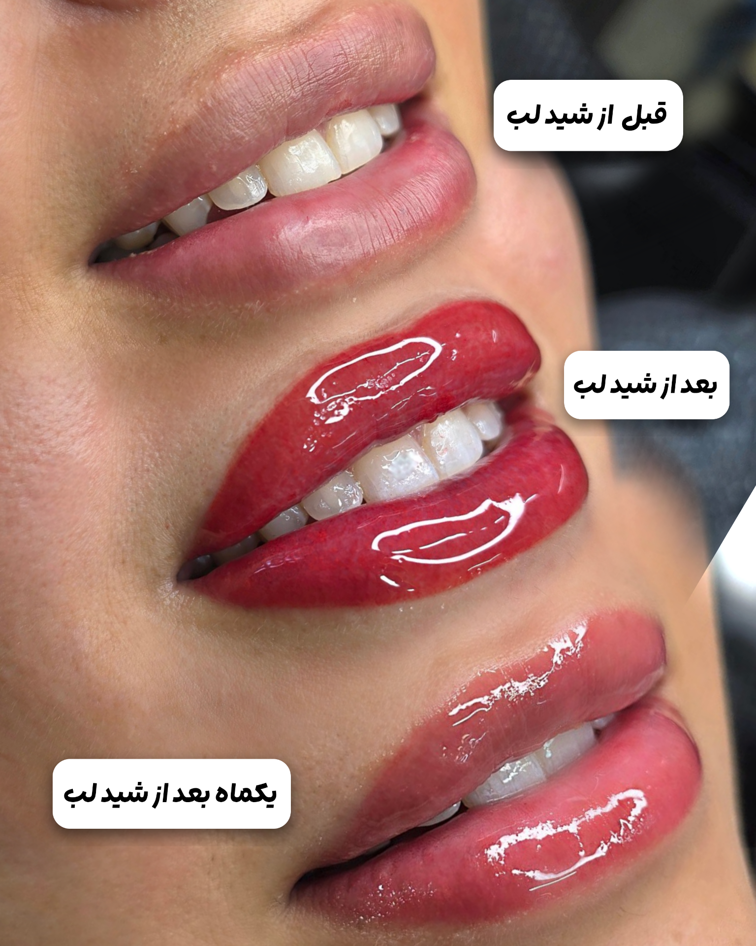نمونه کار غزاله دادخواه — لیفت و لمینت مژه