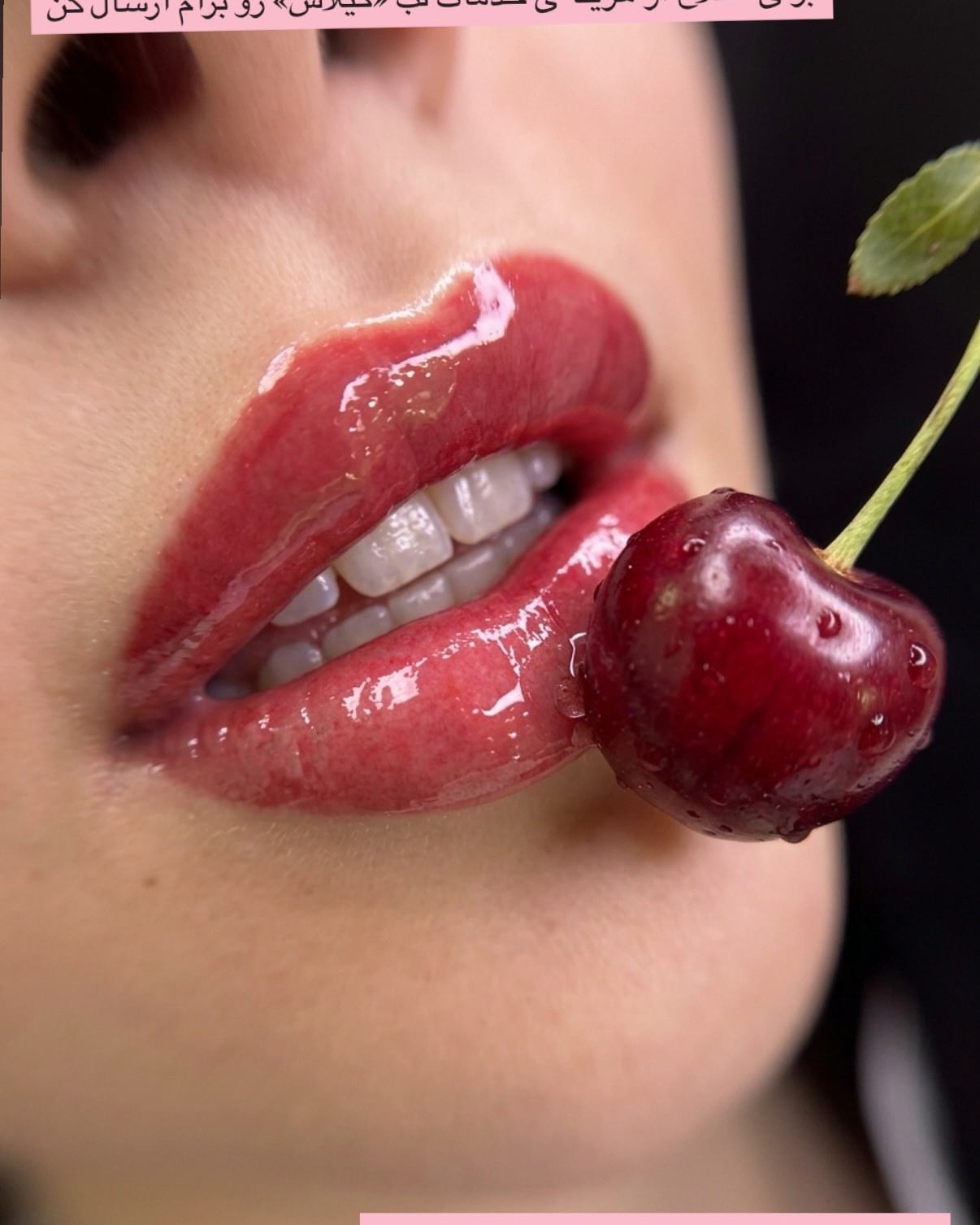 نمونه کار مرضیه سلطانی نژاد — لیفت و لمینت مژه