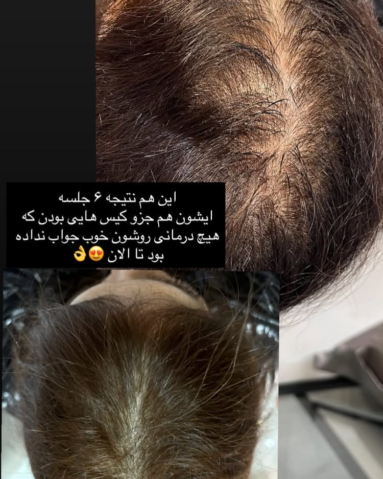 نمونه کار مهشید وثوق — لیفت و لمینت مژه