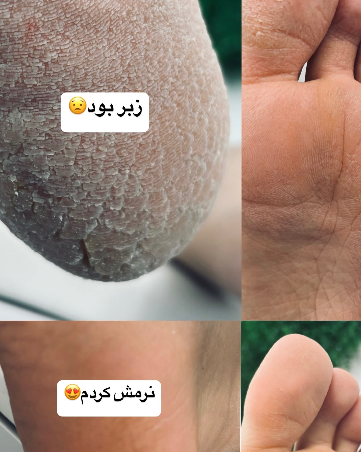 نمونه کار صبا خراسانی — لیفت و لمینت مژه