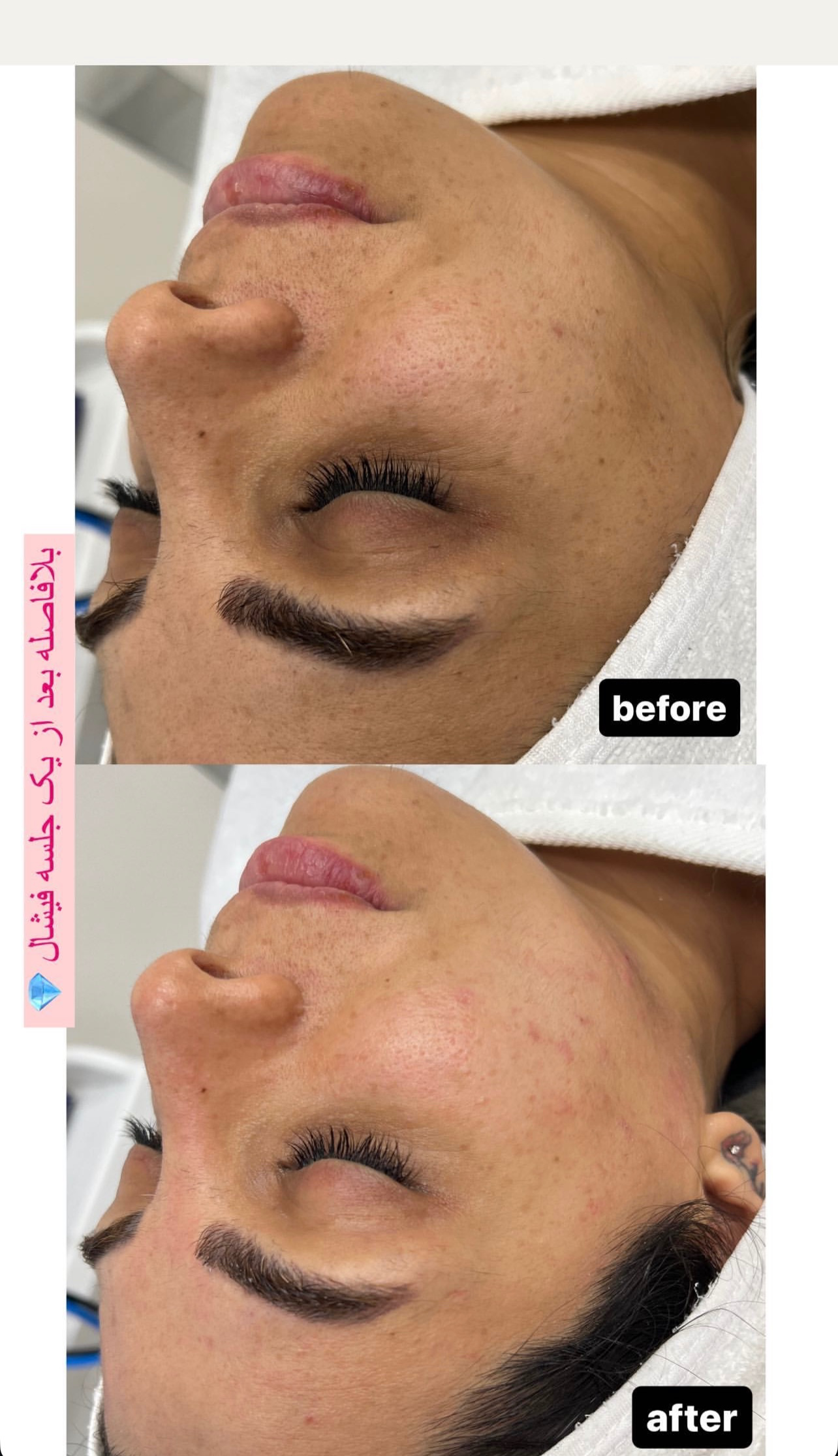 نمونه کار پرنیا شکوهی — لیفت و لمینت مژه