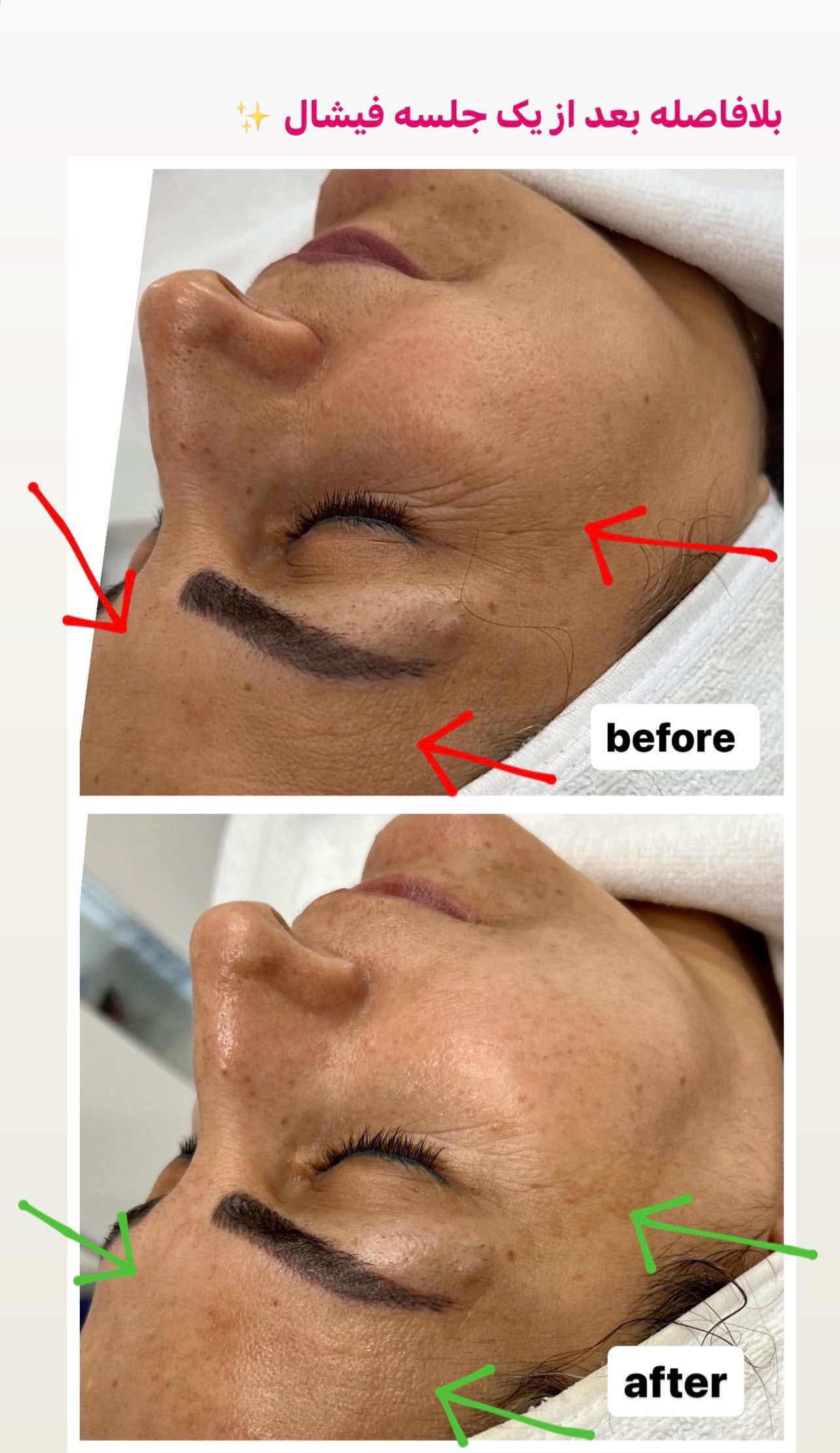 نمونه کار پرنیا شکوهی — لیفت و لمینت مژه