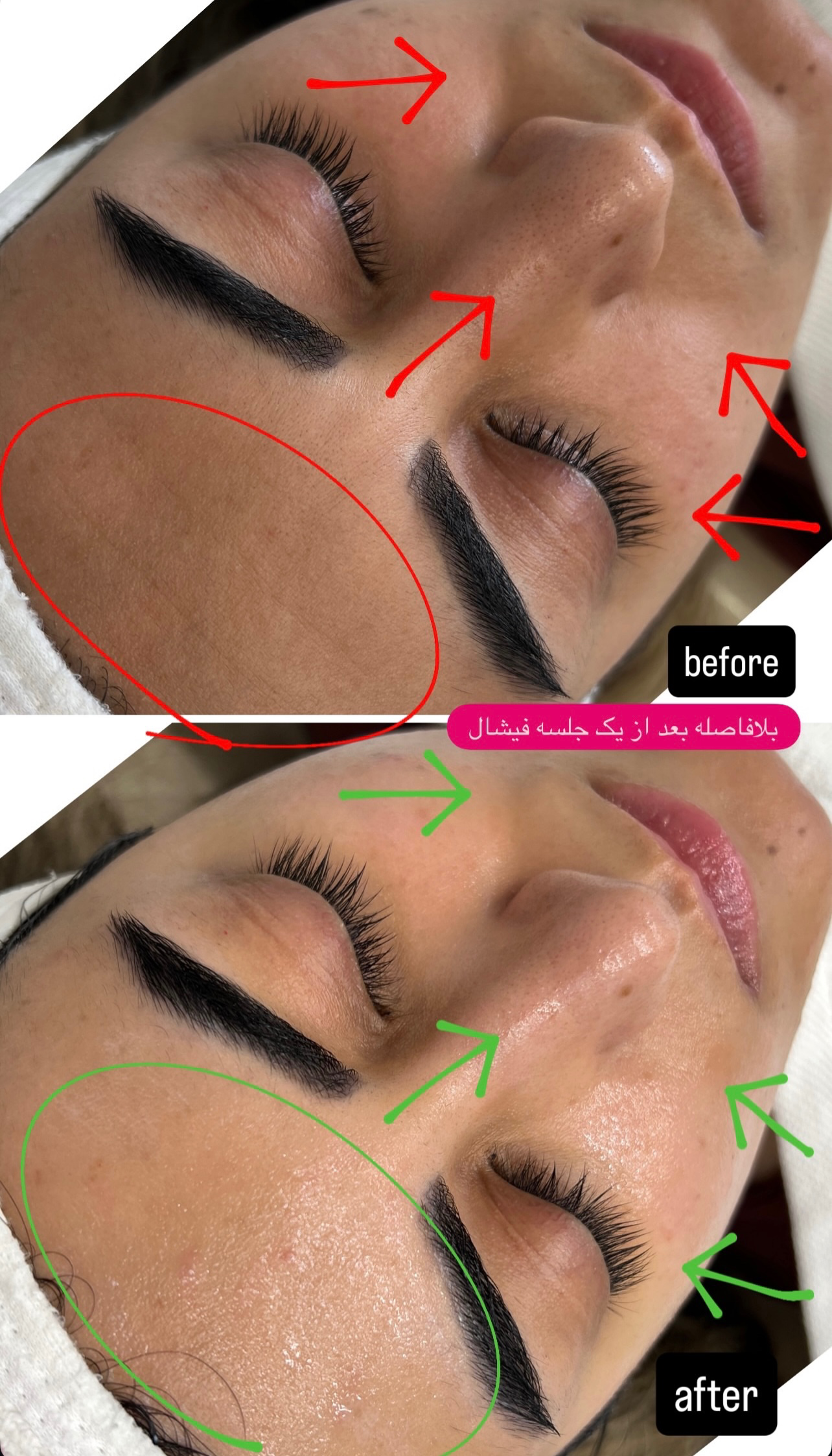 نمونه کار پرنیا شکوهی — لیفت و لمینت مژه