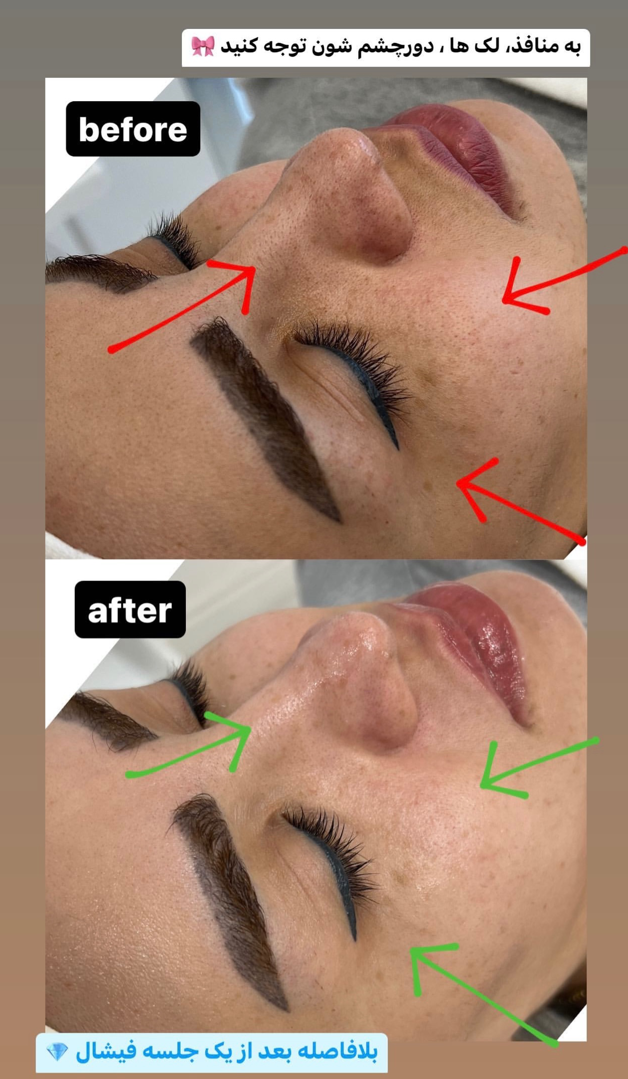 نمونه کار پرنیا شکوهی — لیفت و لمینت مژه