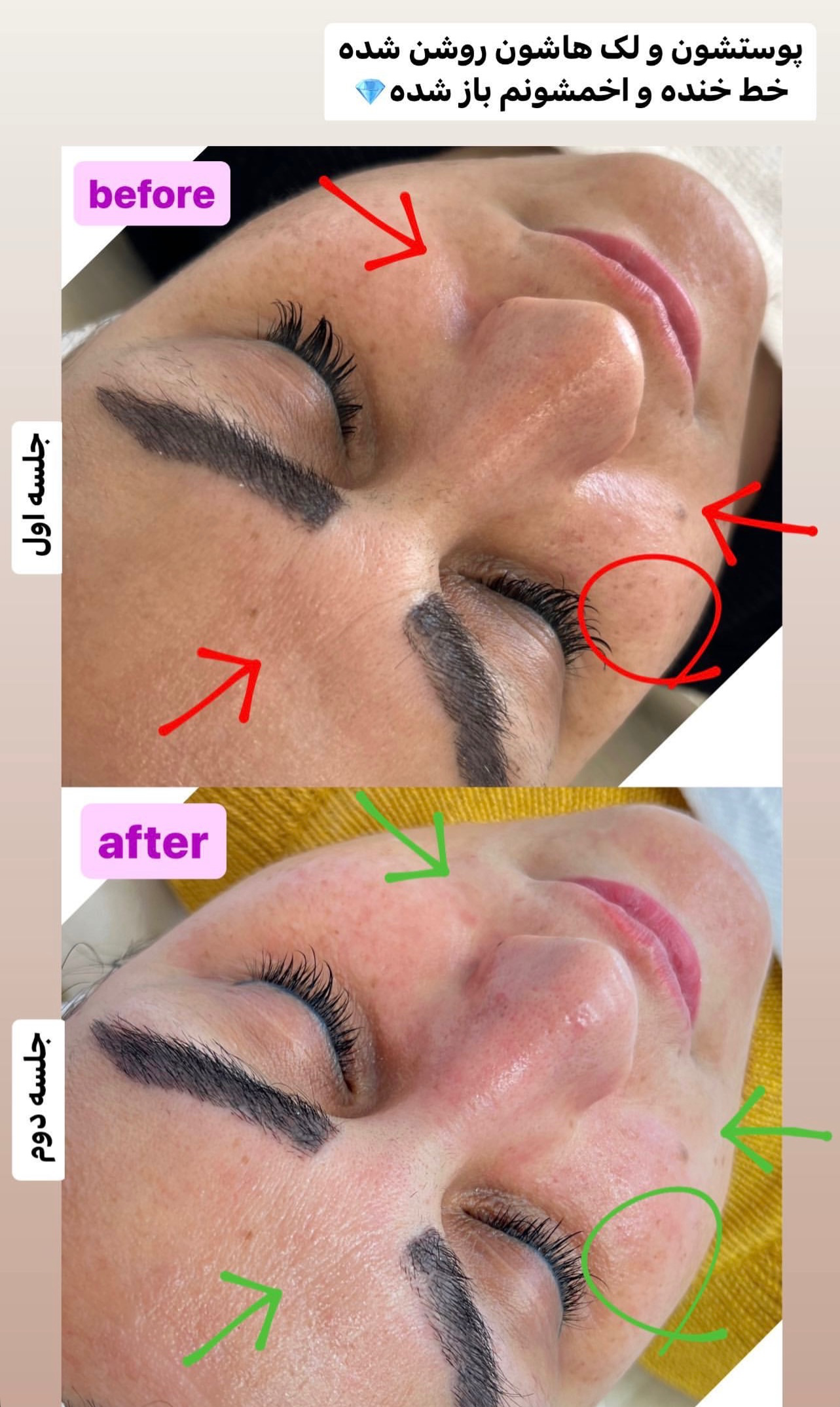 نمونه کار پرنیا شکوهی — لیفت و لمینت مژه