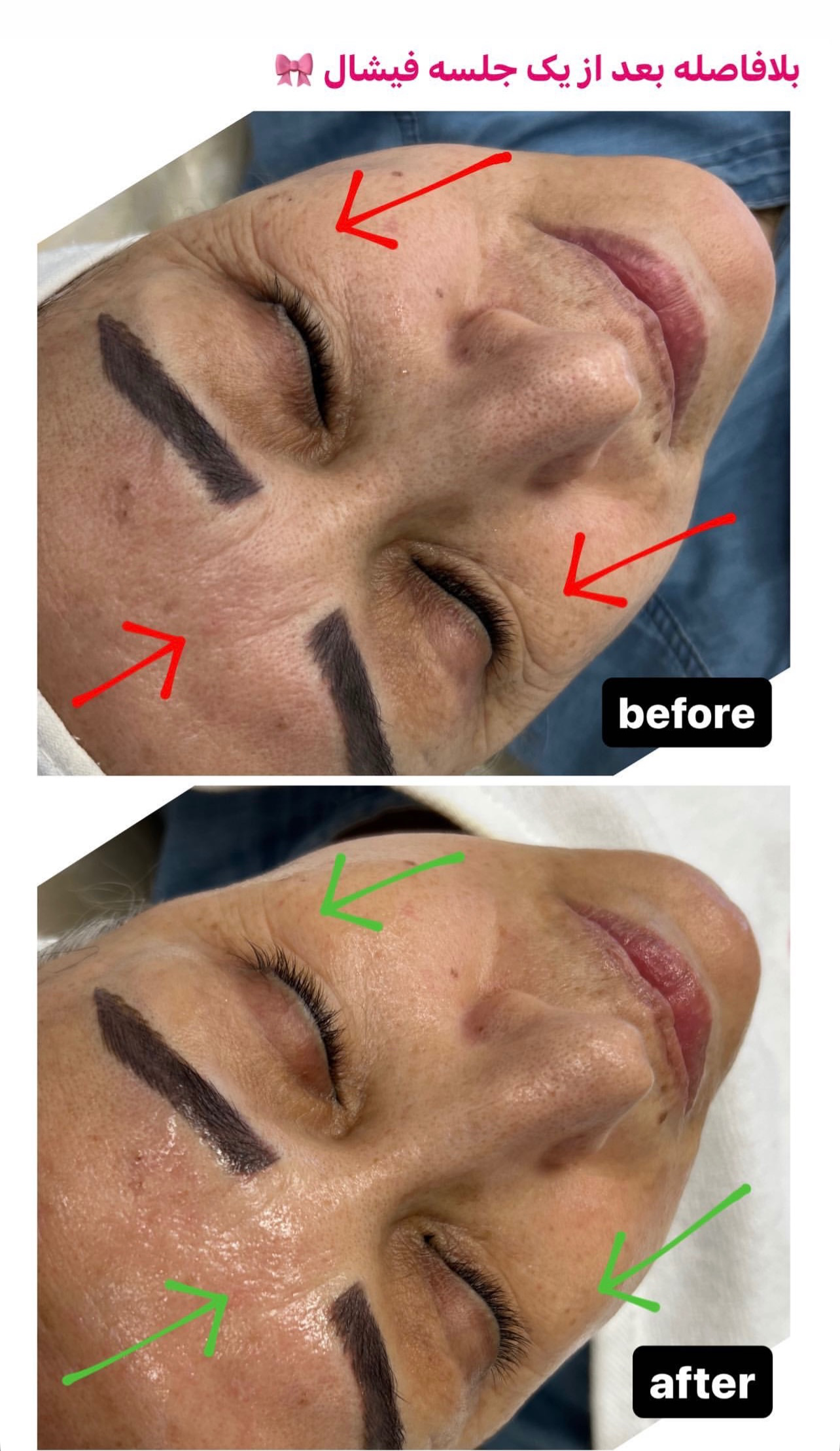 نمونه کار پرنیا شکوهی — لیفت و لمینت مژه