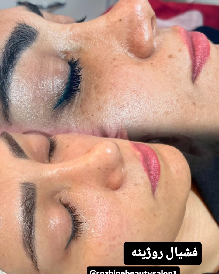 نمونه کار معصومه زند — لیفت و لمینت مژه