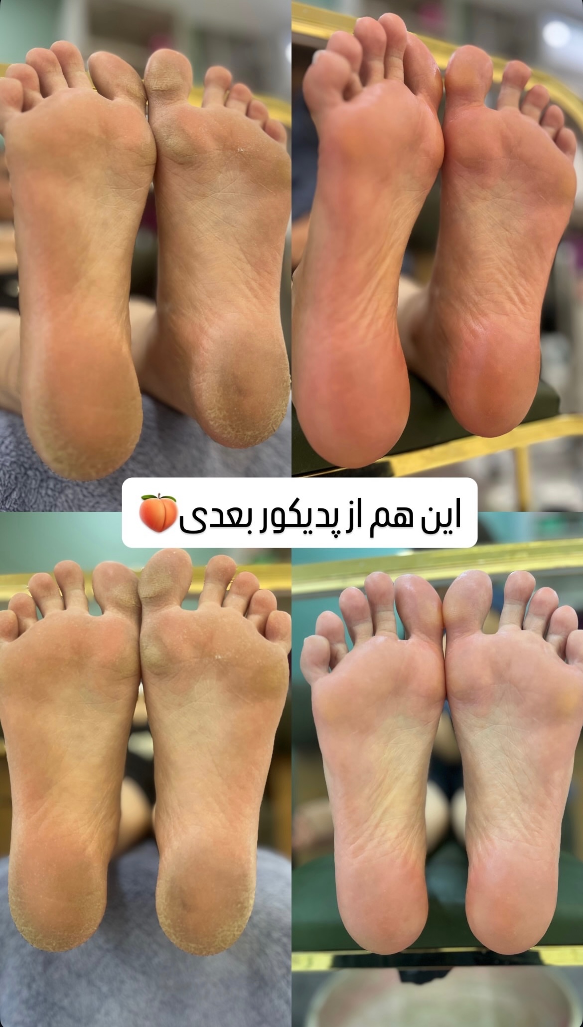 نمونه کار حدیثه محمدی — لیفت و لمینت مژه