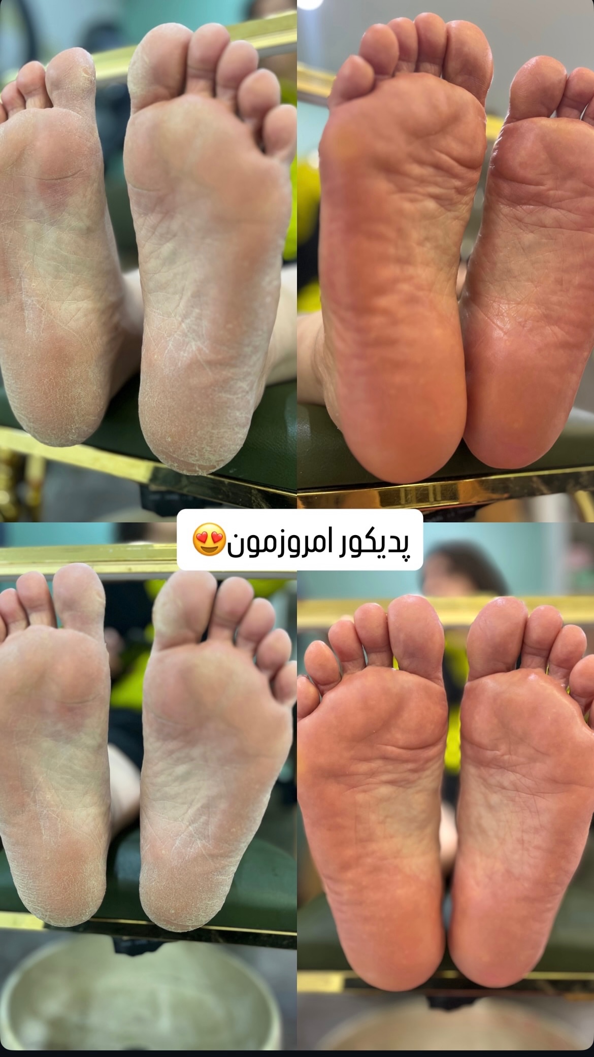 نمونه کار حدیثه محمدی — لیفت و لمینت مژه