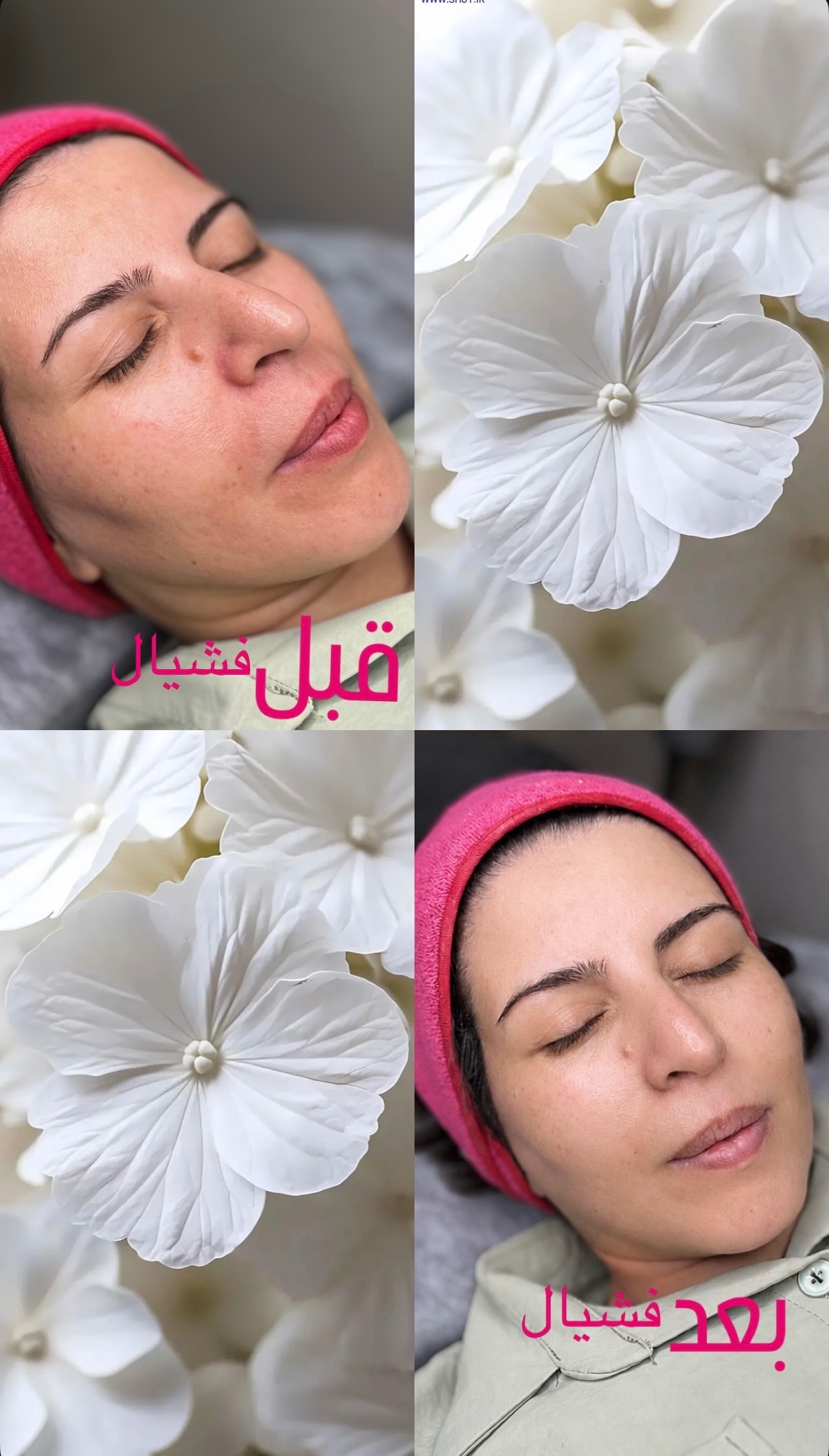 نمونه کار حدیثه محمدی — لیفت و لمینت مژه