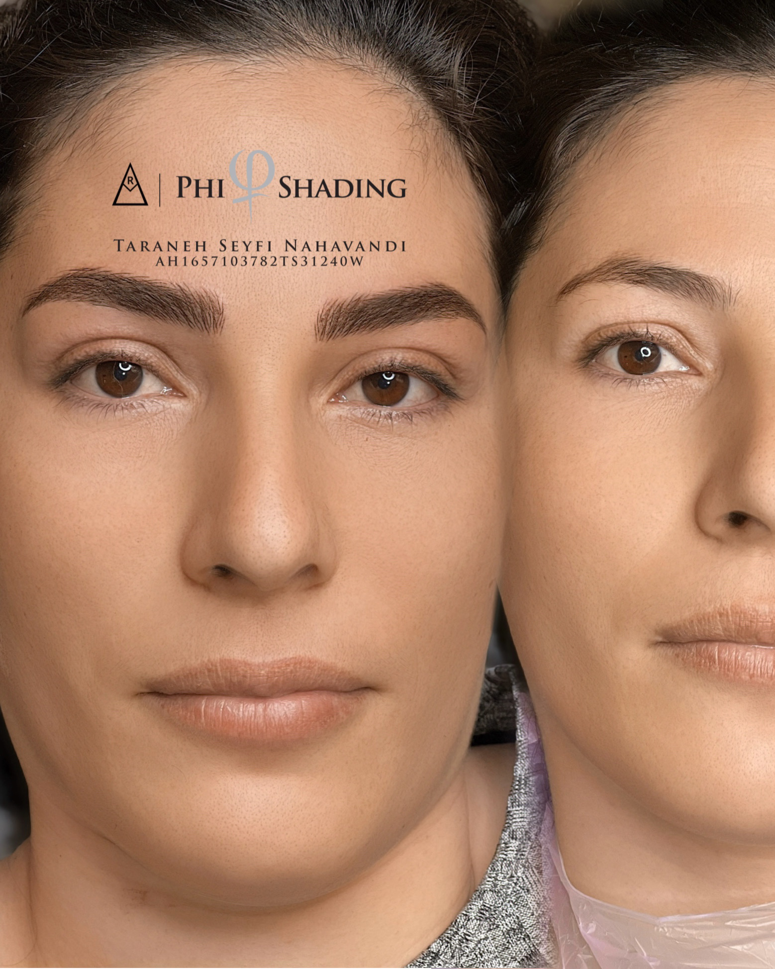 نمونه کار ترانه صیفی — لیفت و لمینت مژه