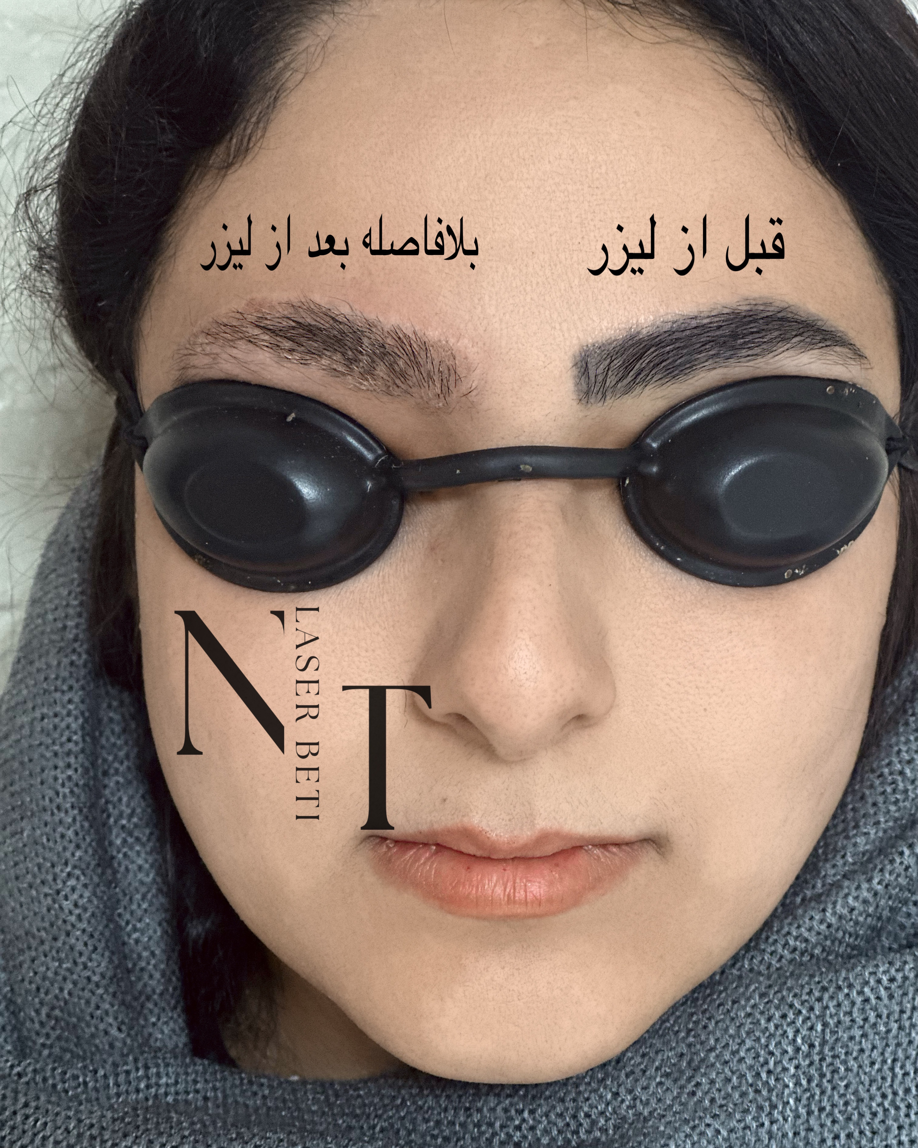 نمونه کار ترانه صیفی — لیفت و لمینت مژه