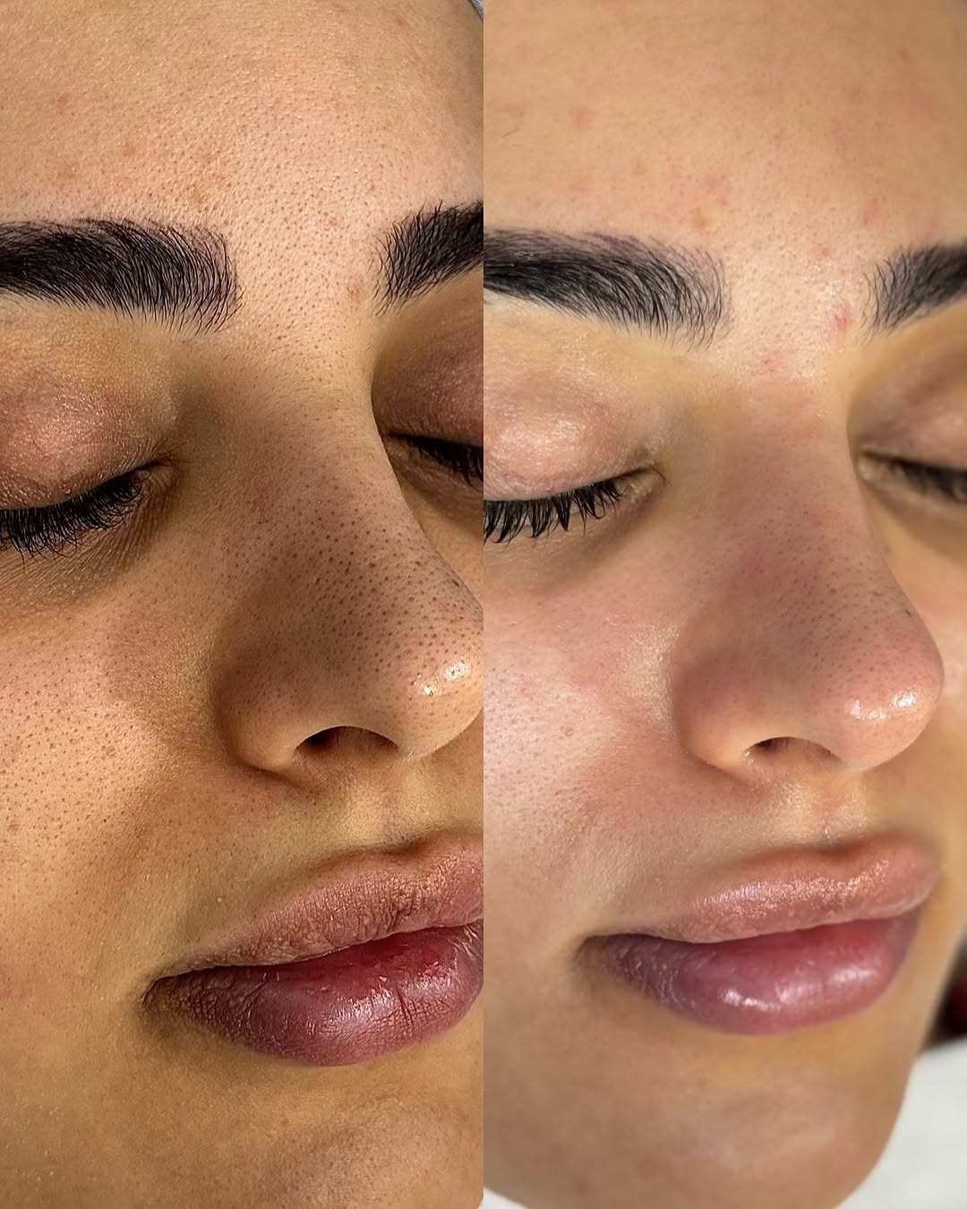 نمونه کار لیلا عقبایی — لیفت و لمینت مژه