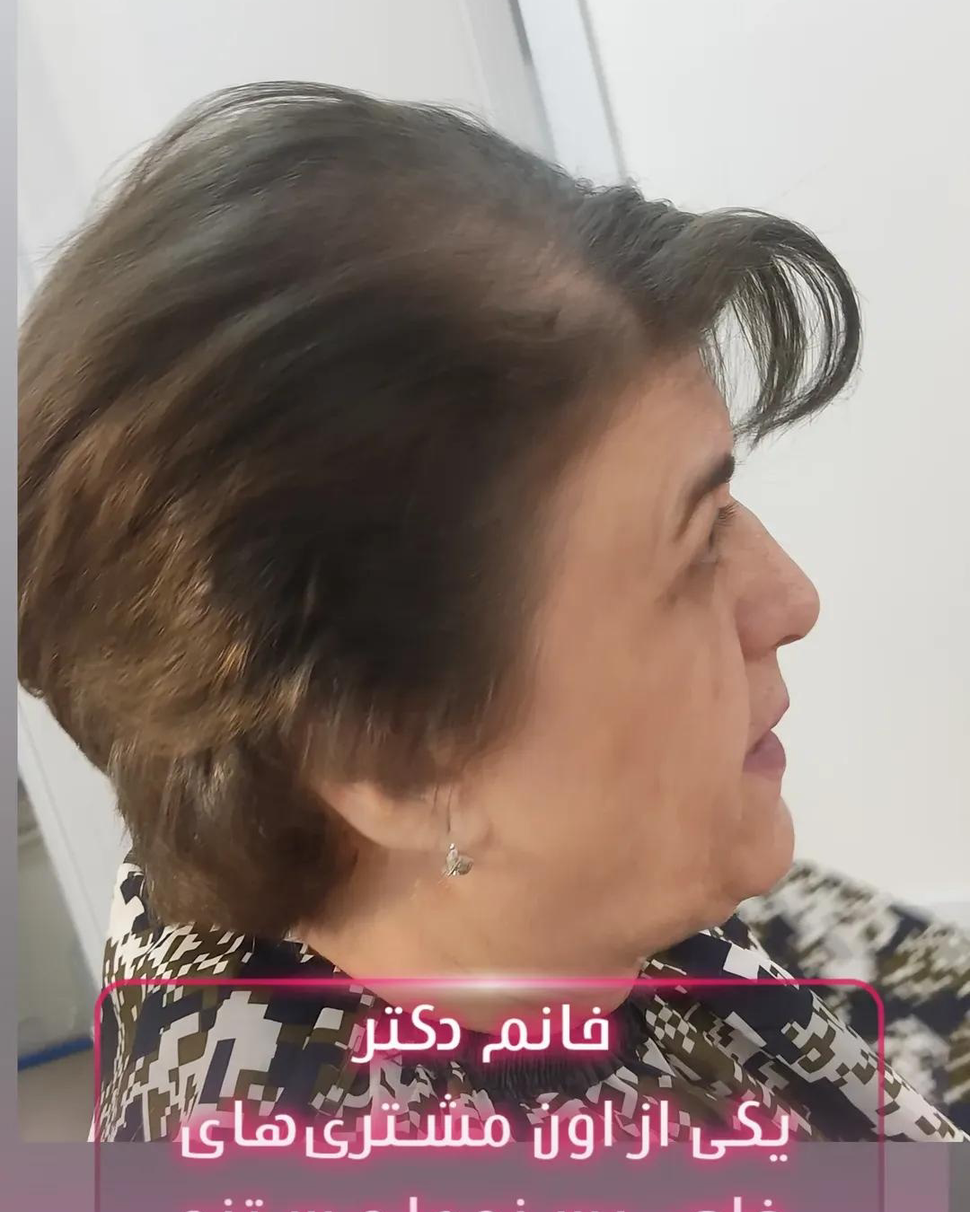 نمونه کار سمیه فردوس — لیفت و لمینت مژه