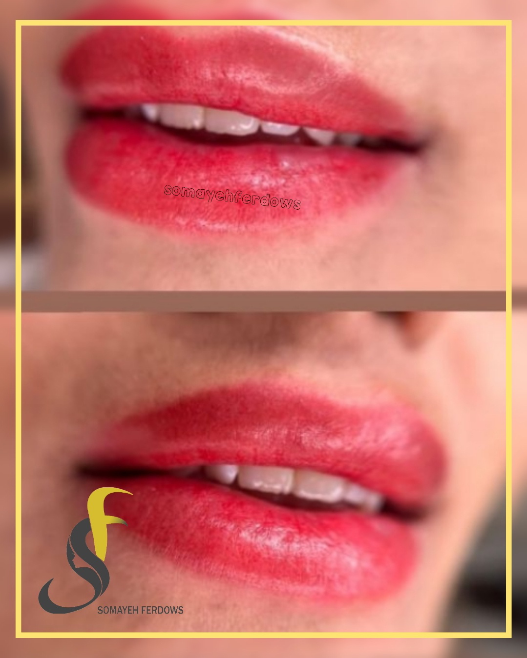 نمونه کار سمیه فردوس — لیفت و لمینت مژه