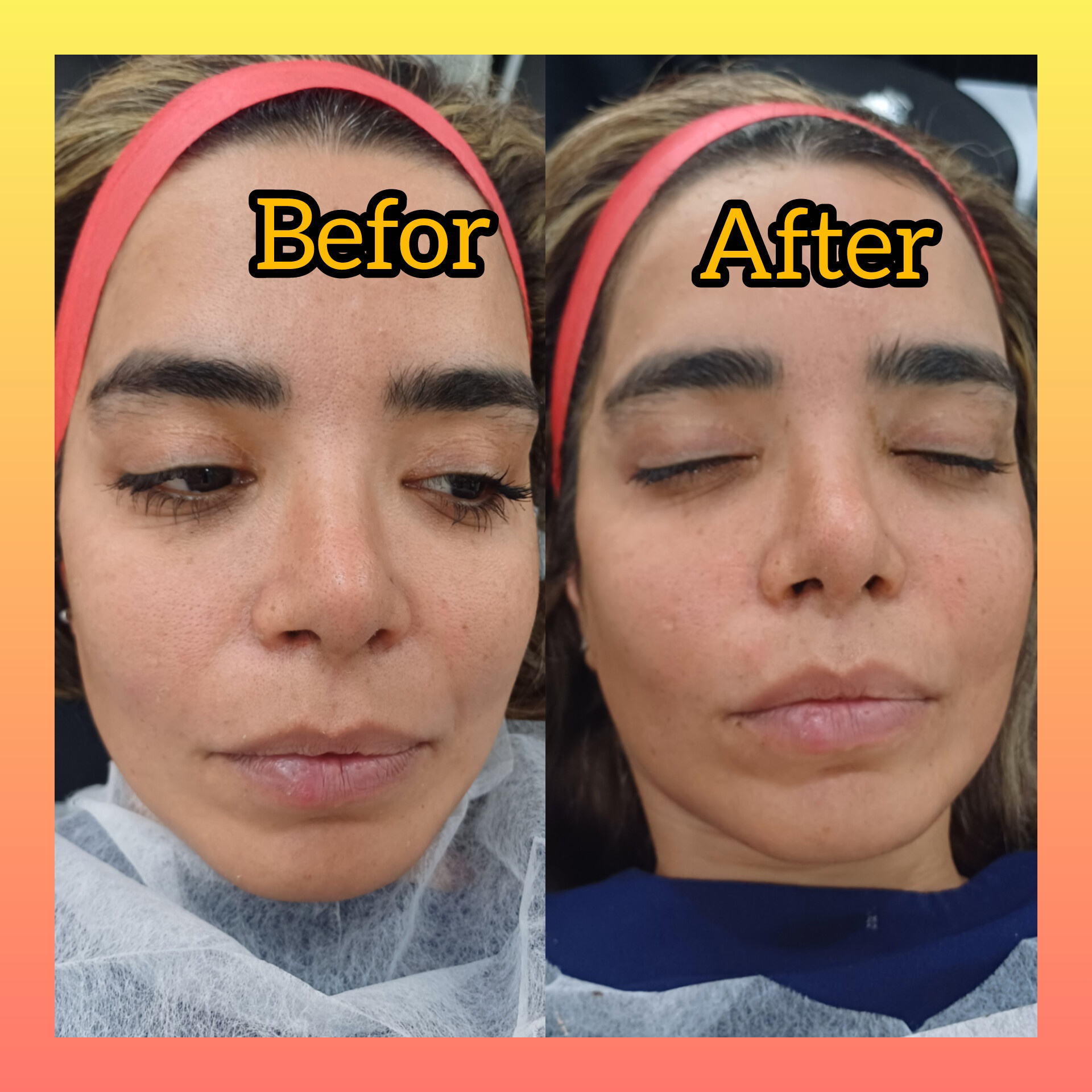 نمونه کار سمیه سادات میرحسینی — لیفت و لمینت مژه
